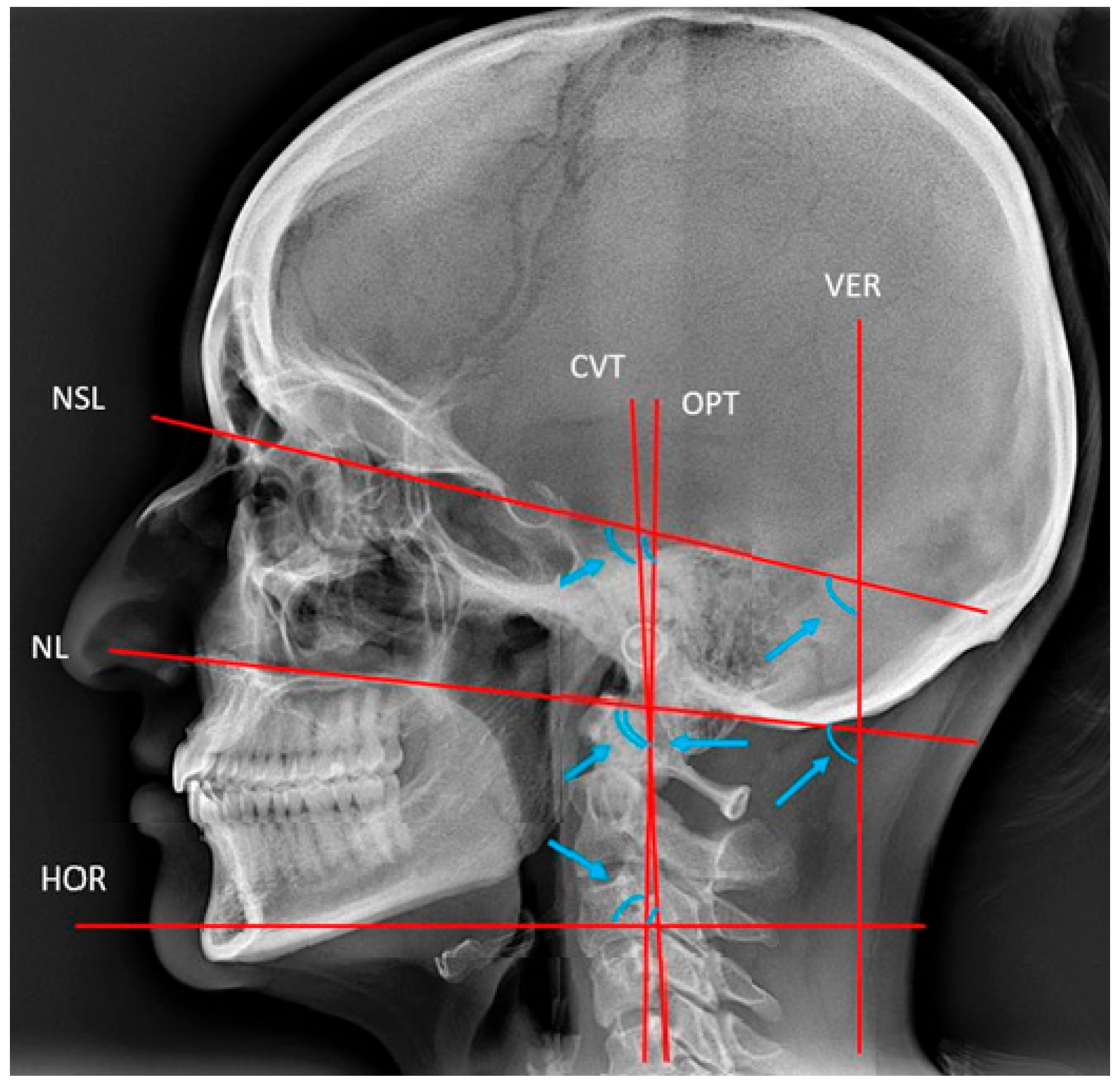 Dentistry 13 00136 g005
