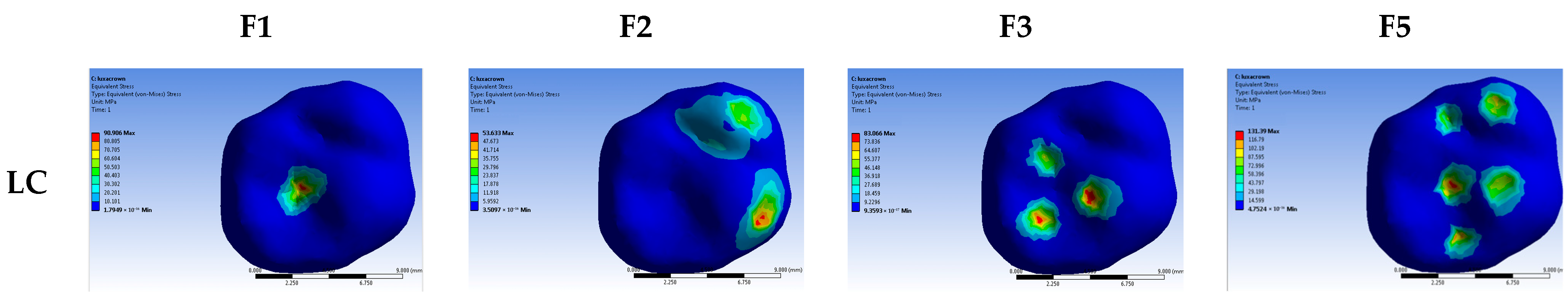 Dentistry 13 00137 g004