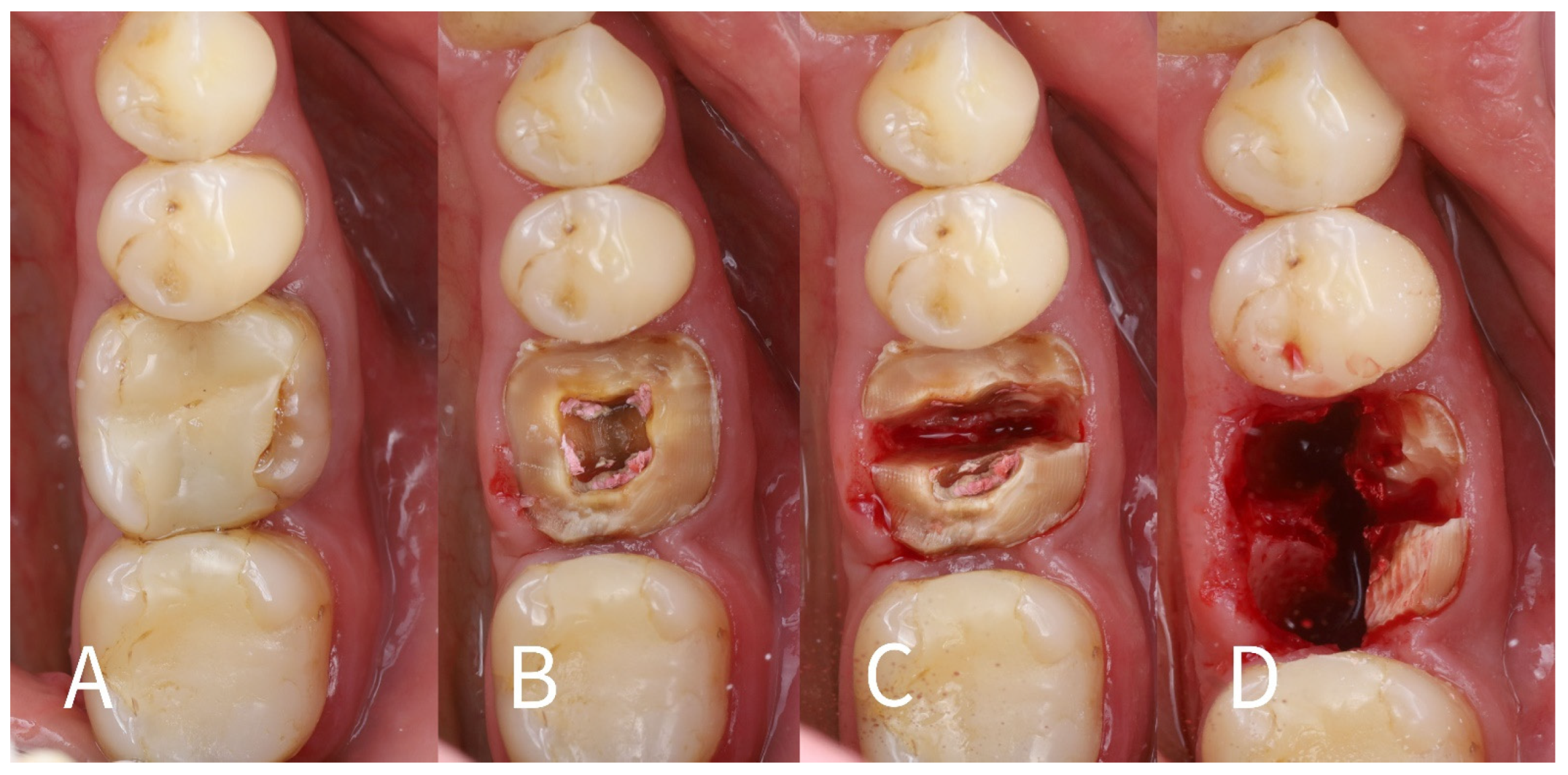 Dentistry 13 00145 g002
