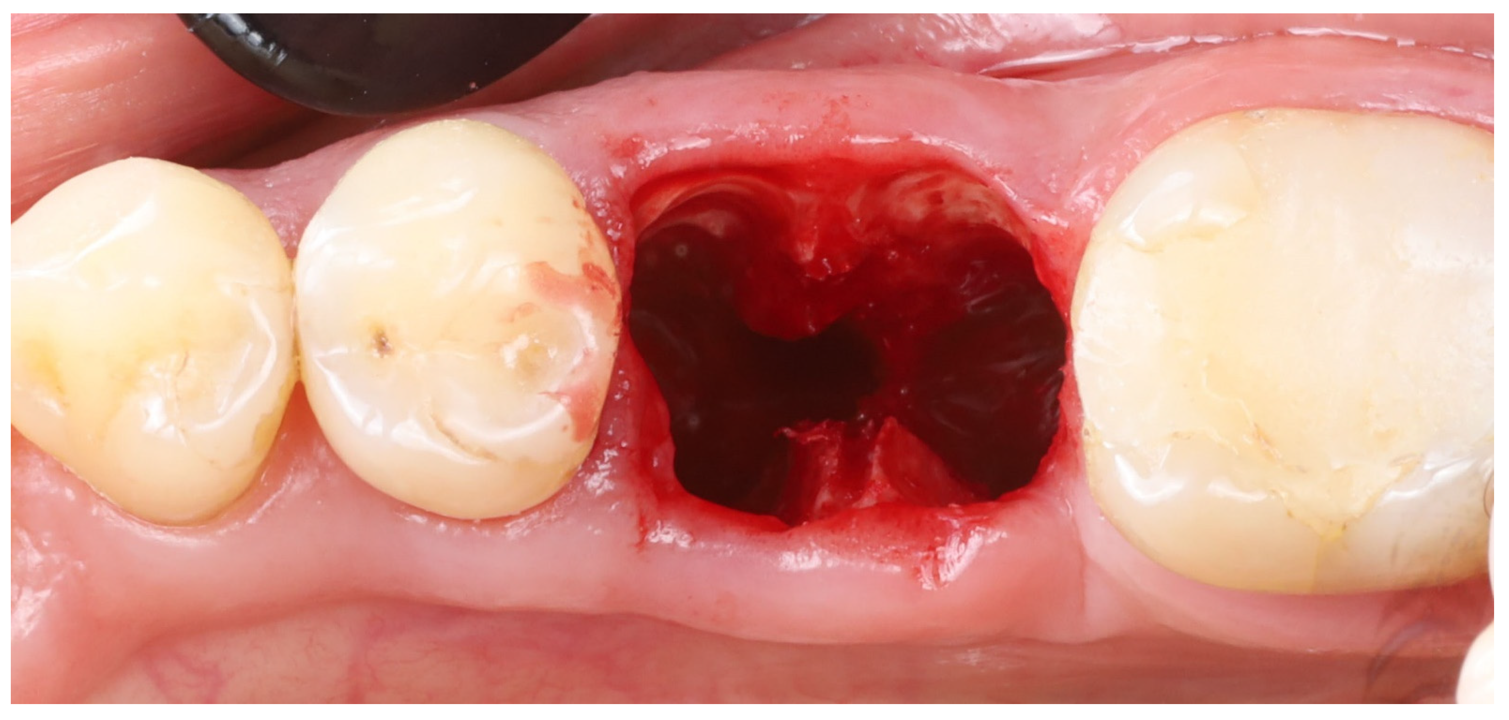Dentistry 13 00145 g003
