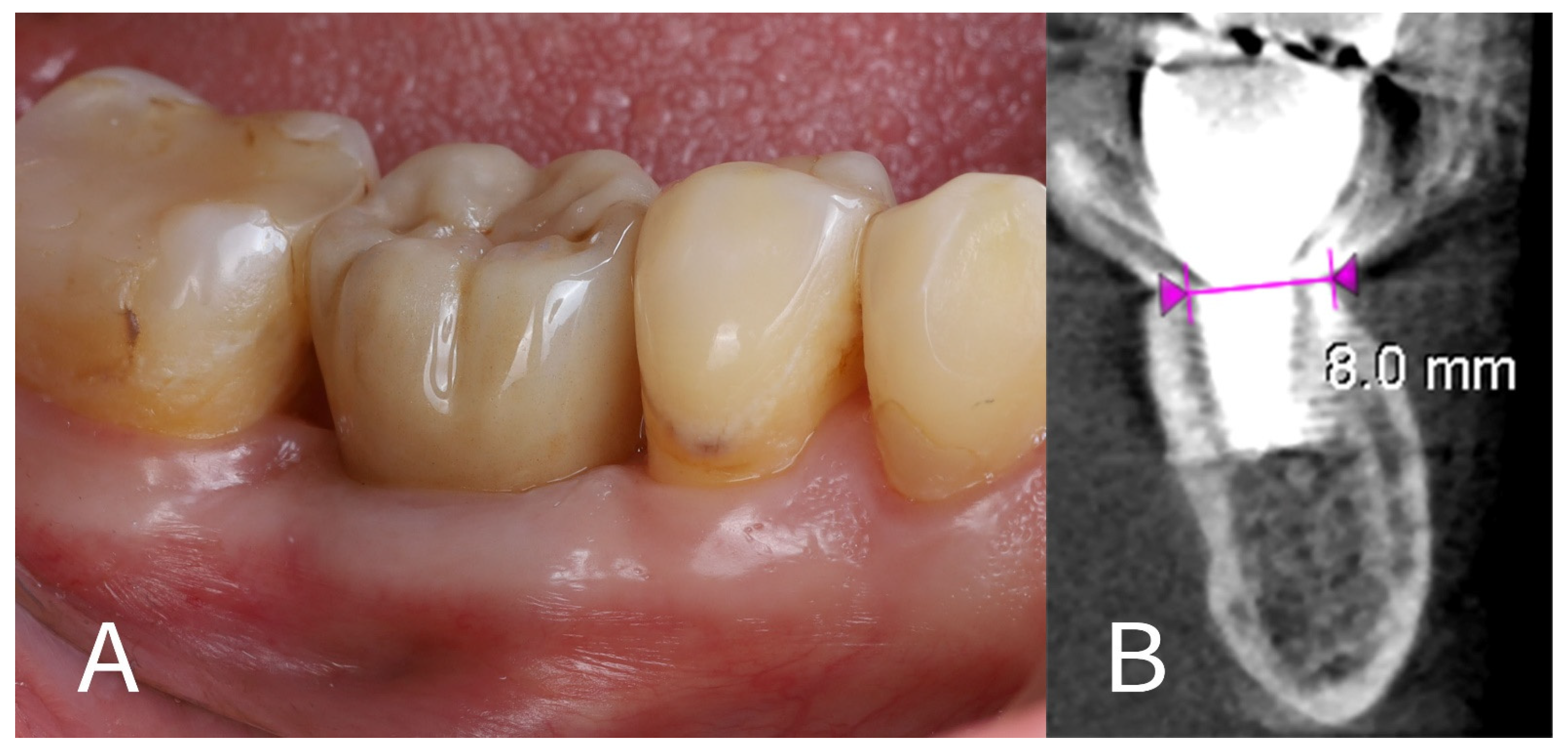 Dentistry 13 00145 g008