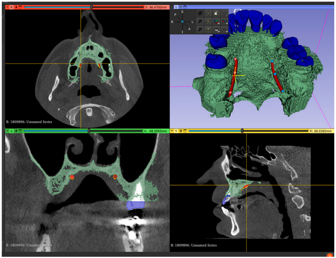 Dentistry 13 00152 g002
