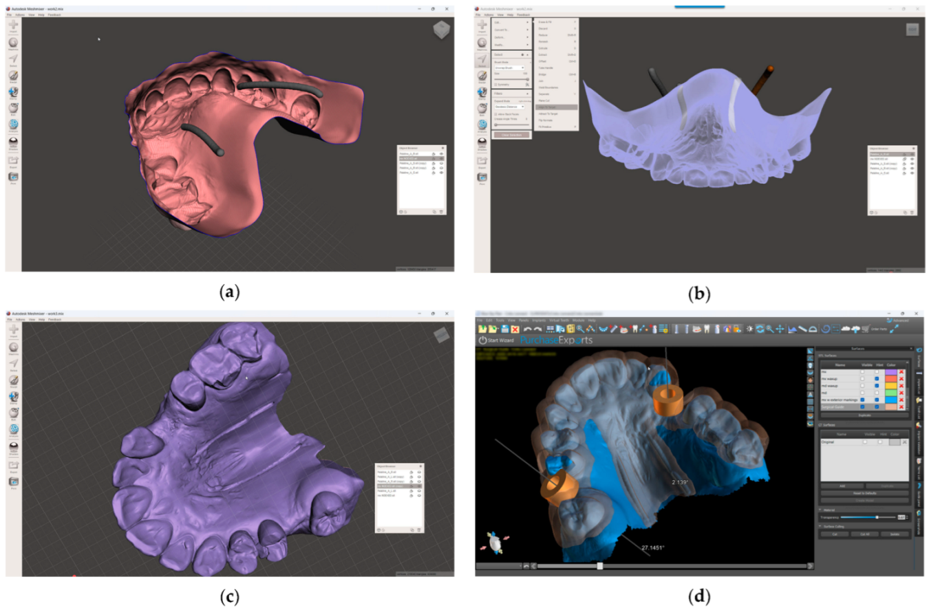 Dentistry 13 00152 g004
