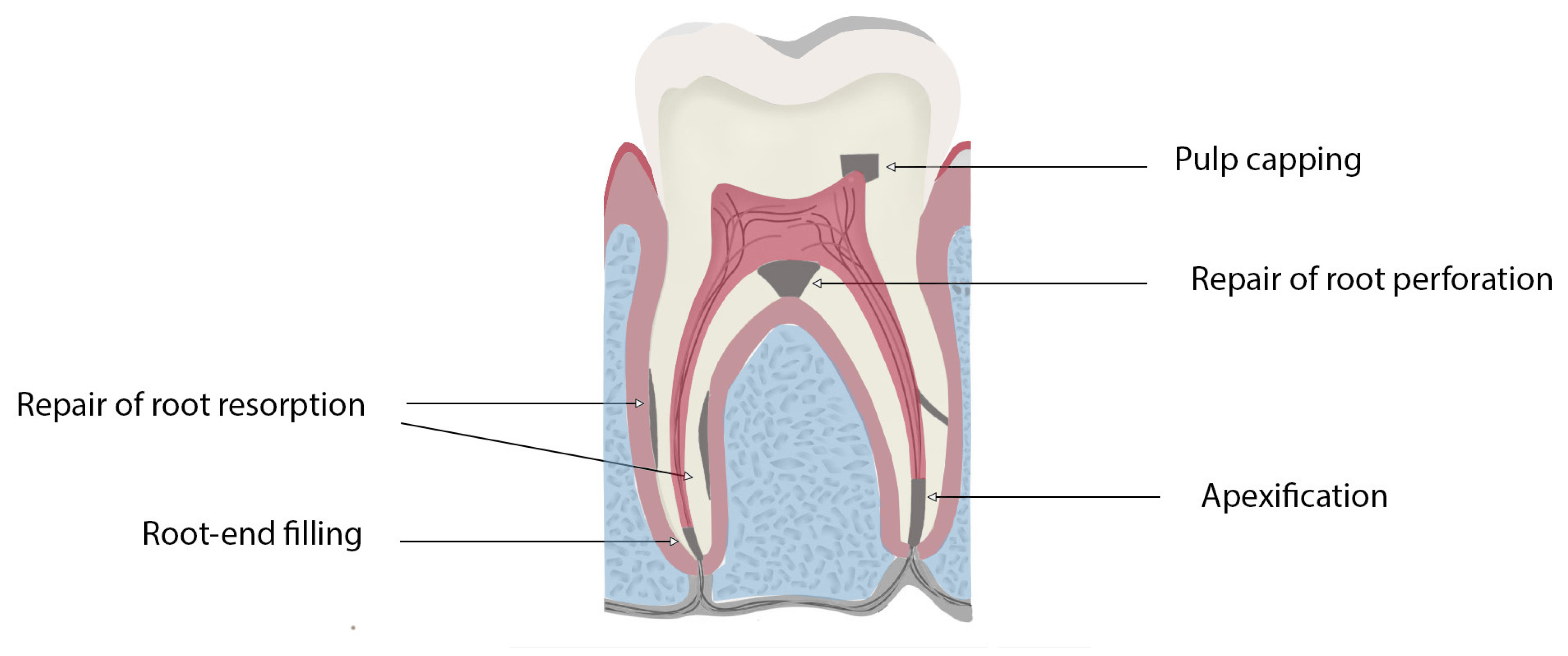 Dentistry 13 00157 g001