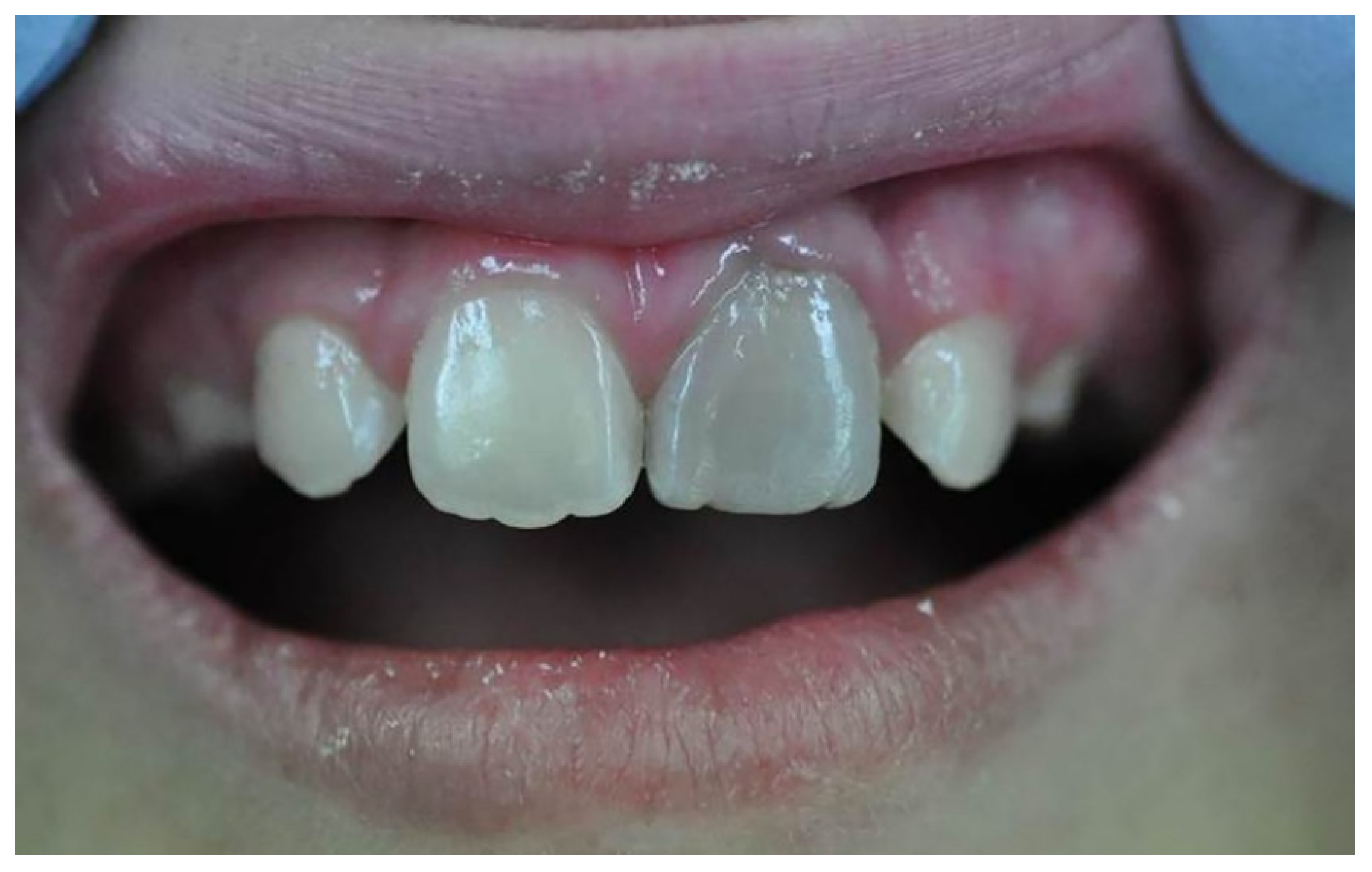 Dentistry 13 00157 g003