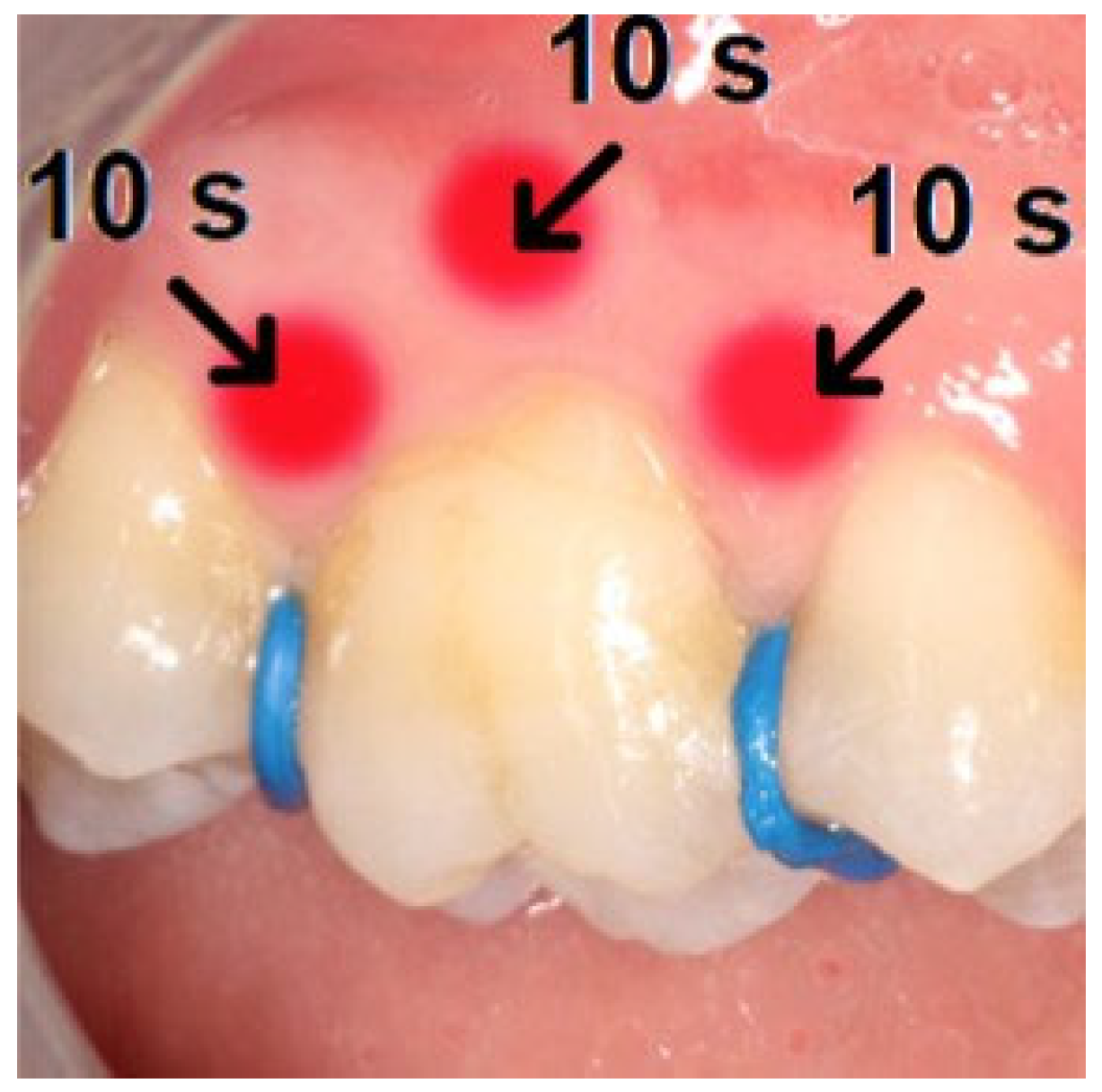 Dentistry 13 00181 g001 Dentistry 13 00181 g001