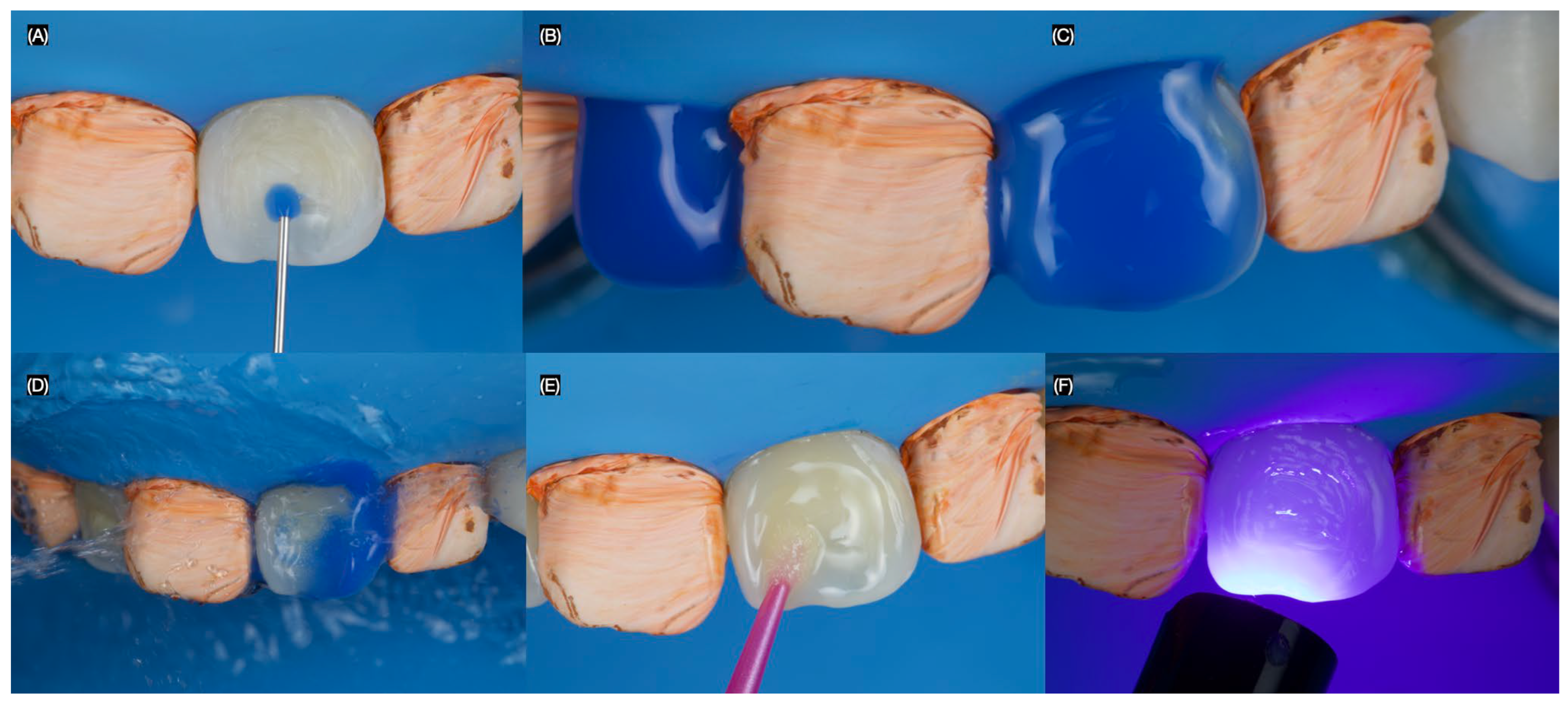 Dentistry 13 00183 g003