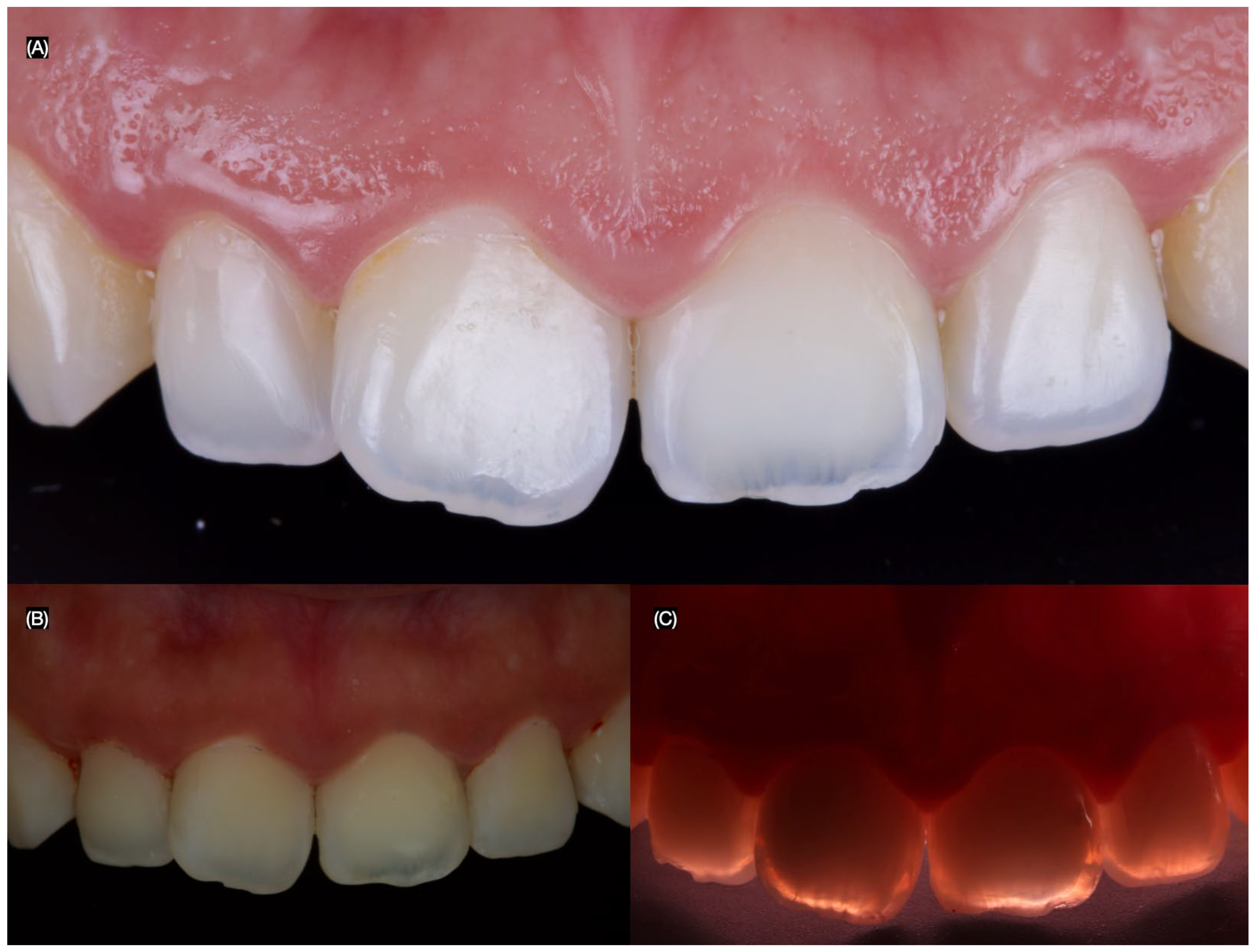 Dentistry 13 00183 g005
