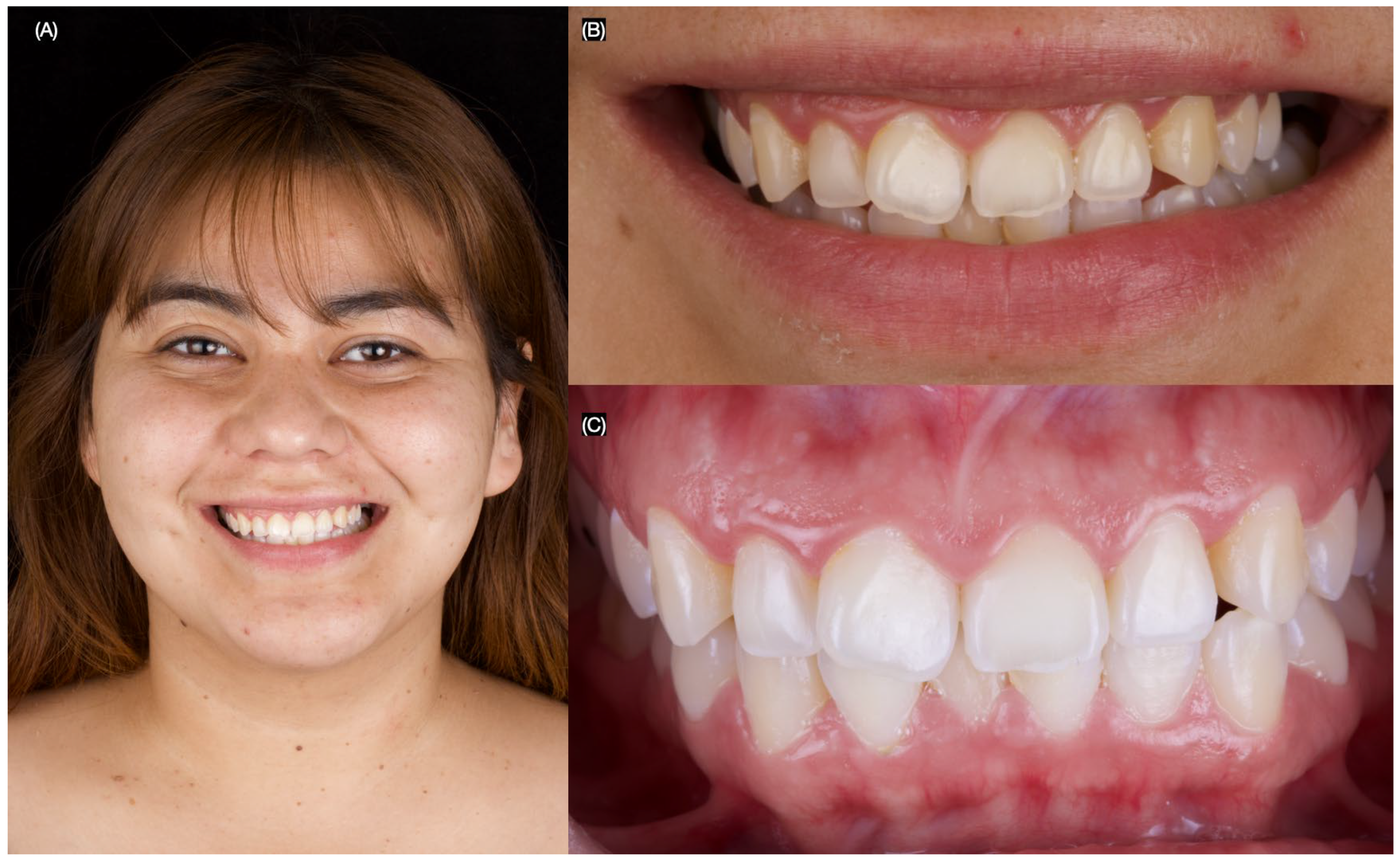 Dentistry 13 00183 g006