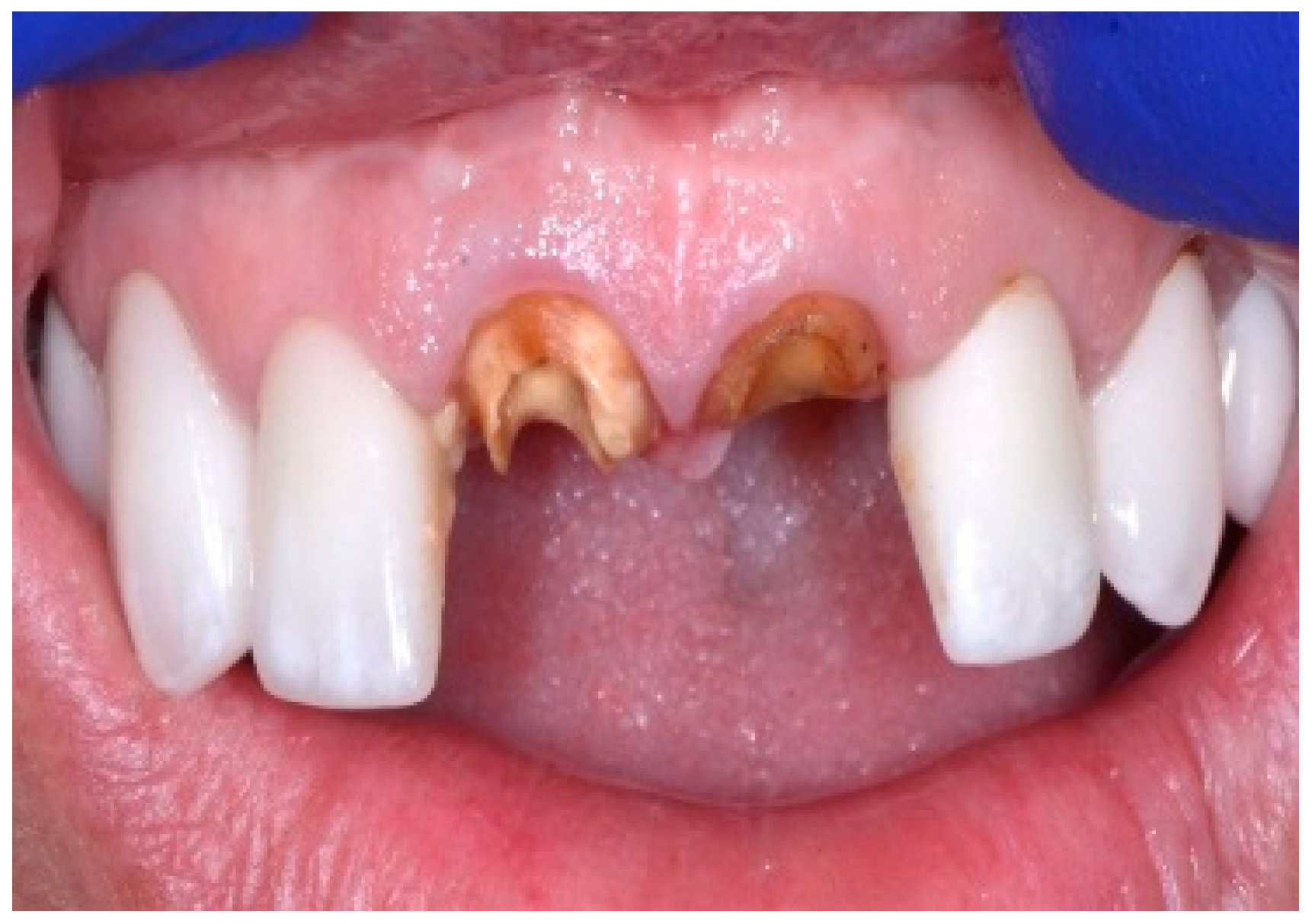 Dentistry 13 00185 g001