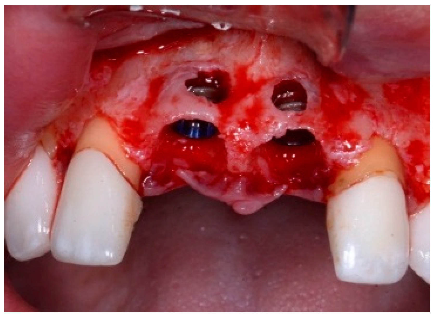 Dentistry 13 00185 g003