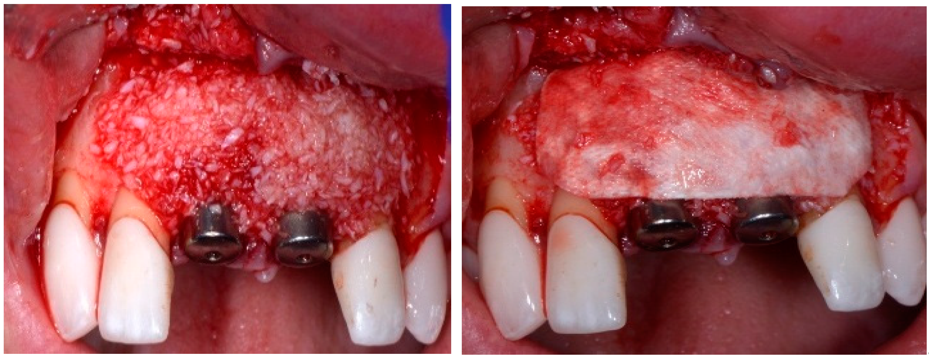Dentistry 13 00185 g004