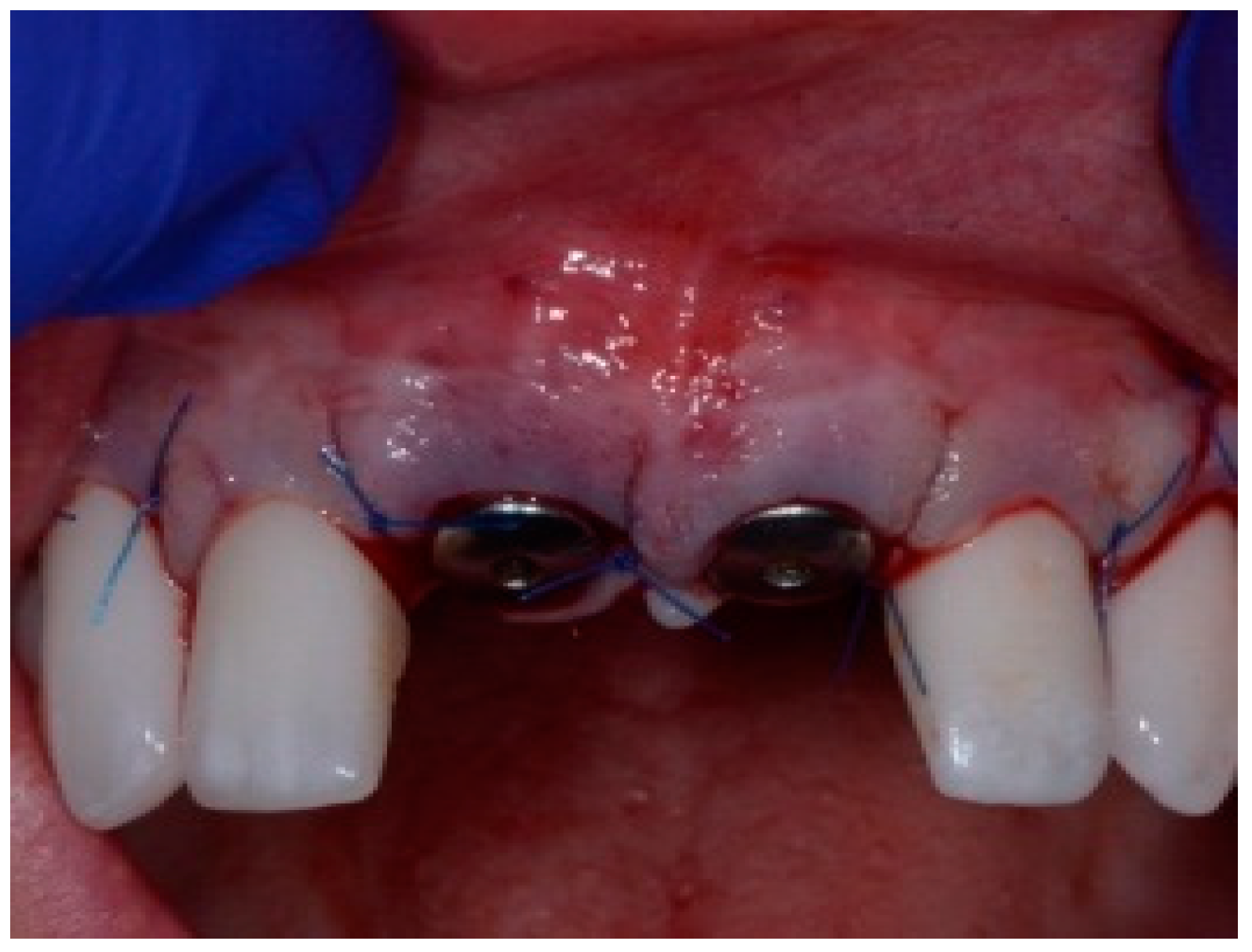 Dentistry 13 00185 g005