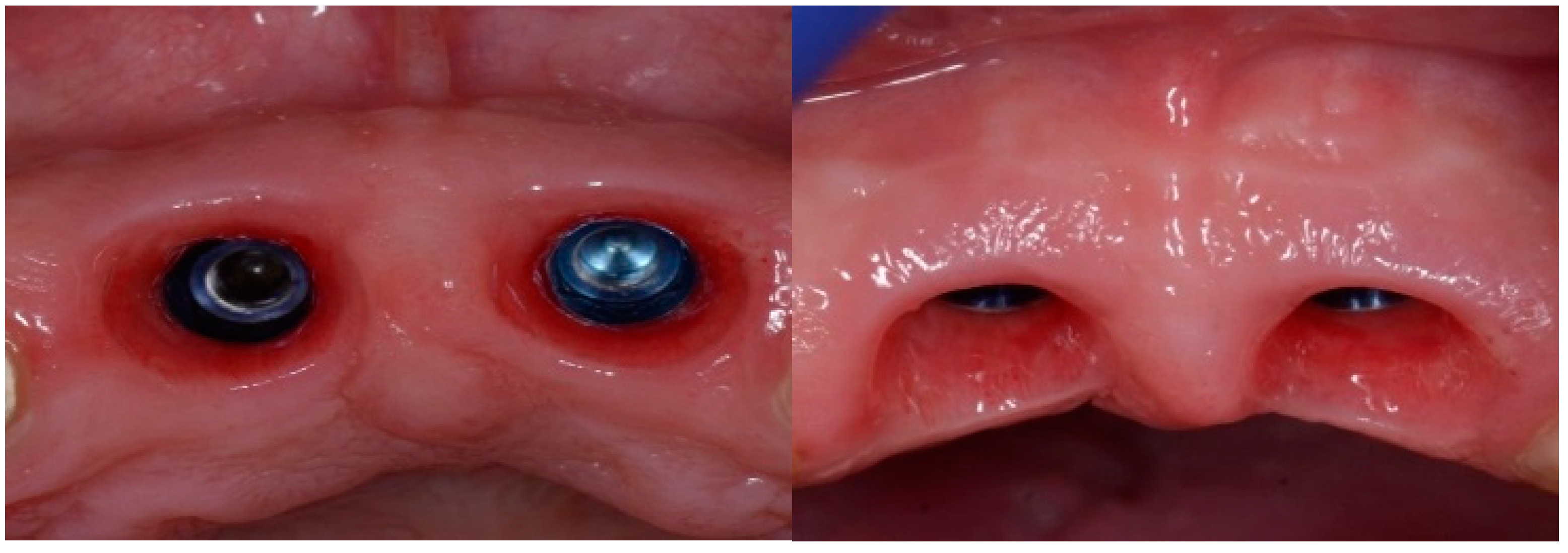 Dentistry 13 00185 g006