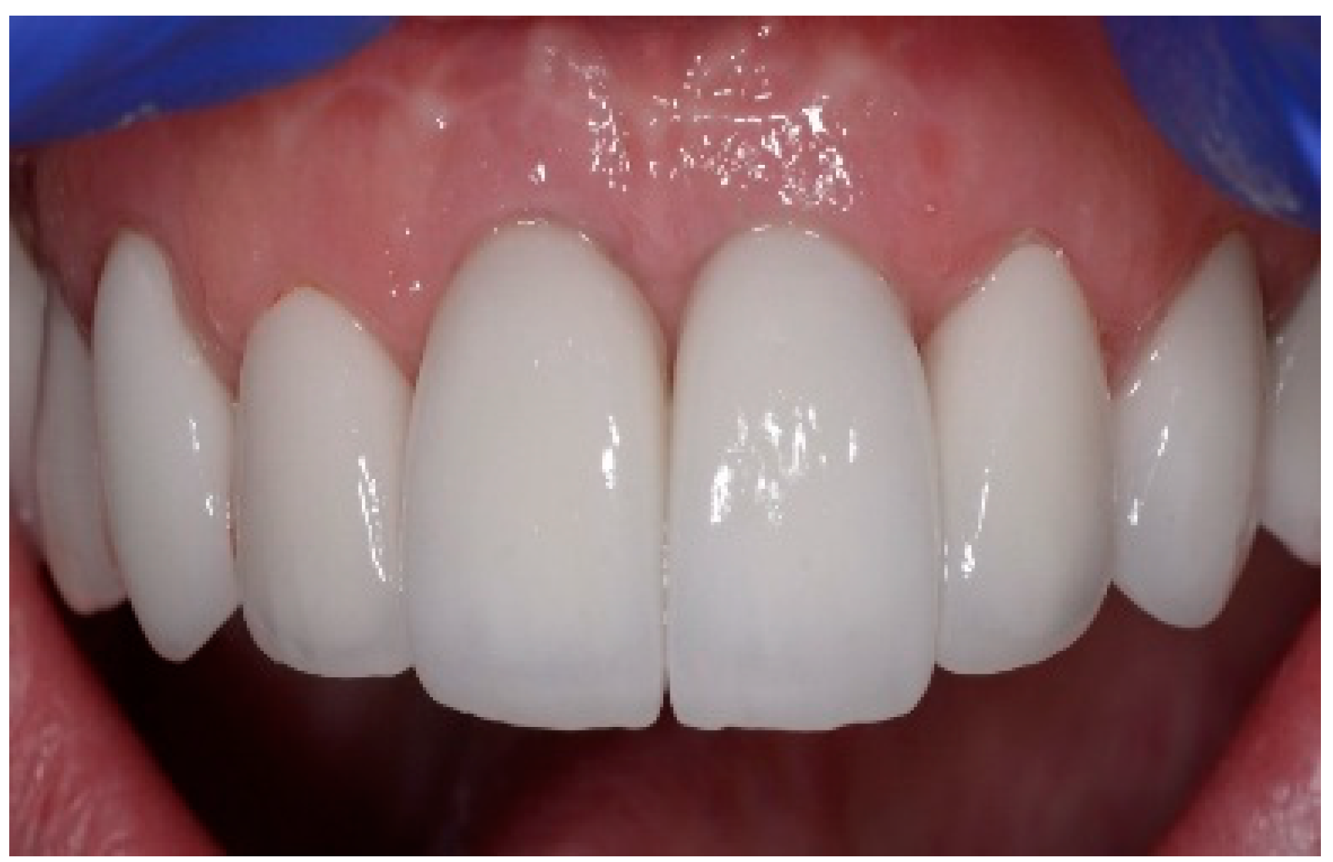 Dentistry 13 00185 g007