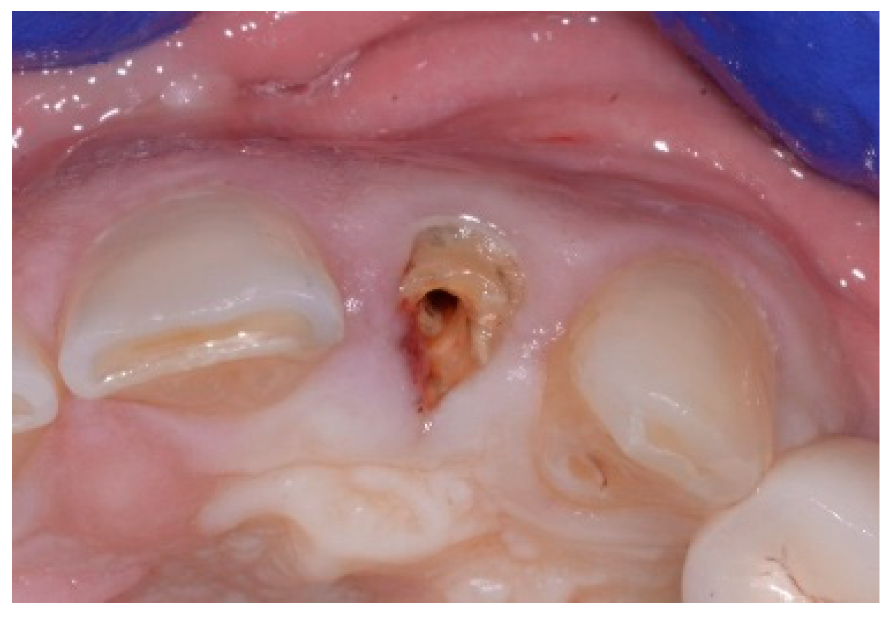 Dentistry 13 00185 g008