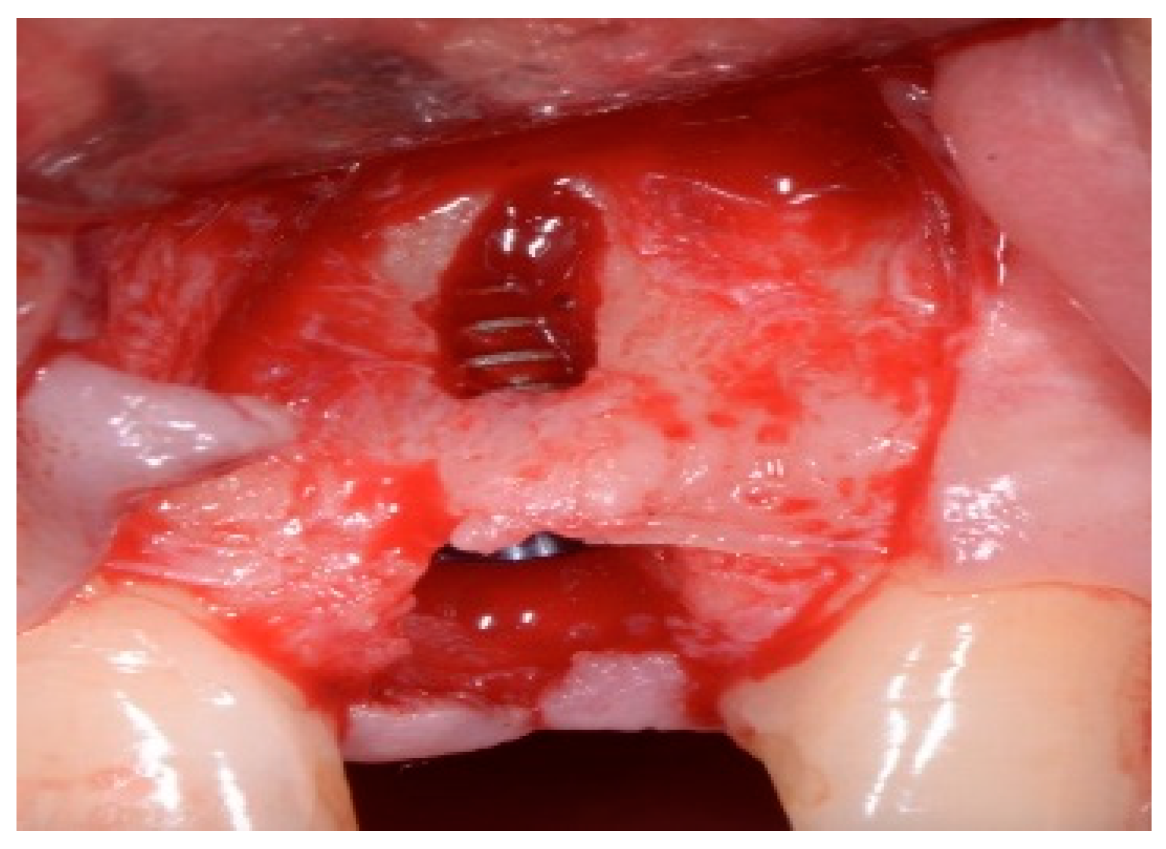 Dentistry 13 00185 g009