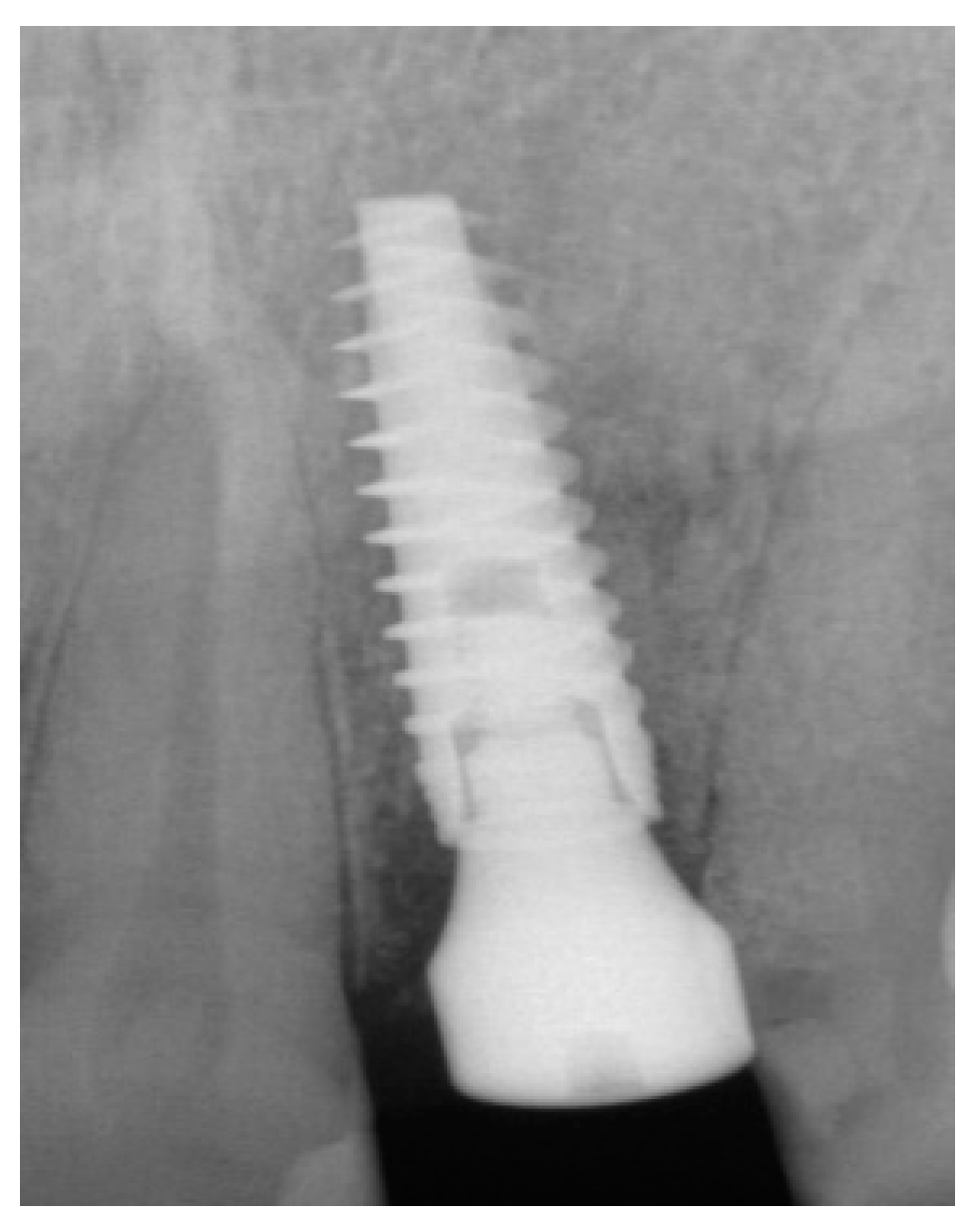 Dentistry 13 00185 g010