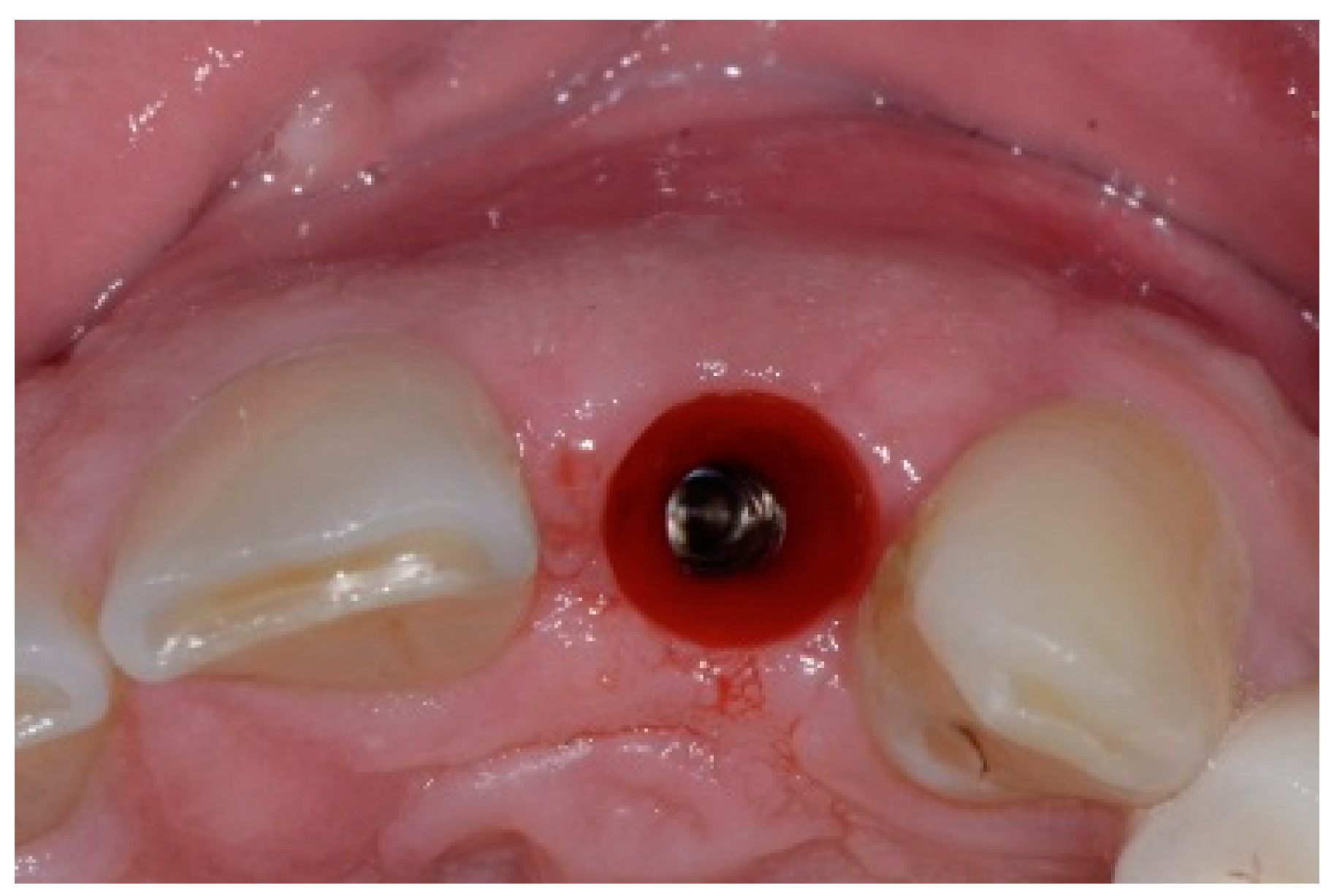 Dentistry 13 00185 g011