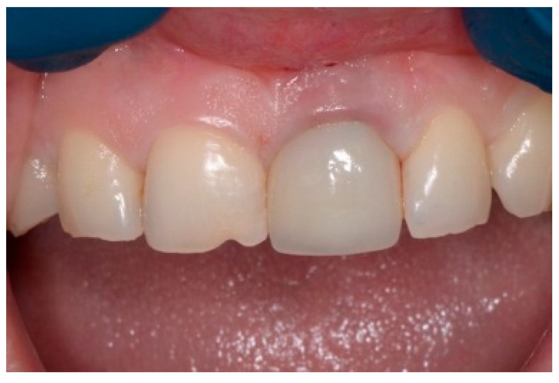 Dentistry 13 00185 g013