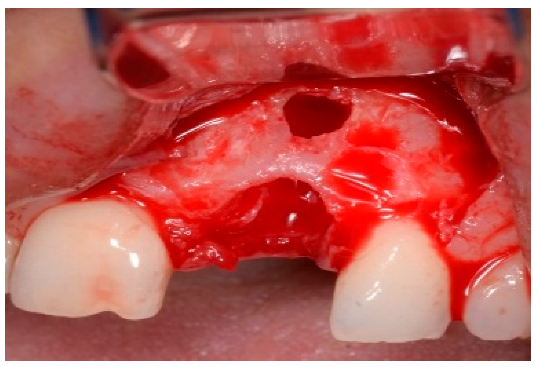 Dentistry 13 00185 g014