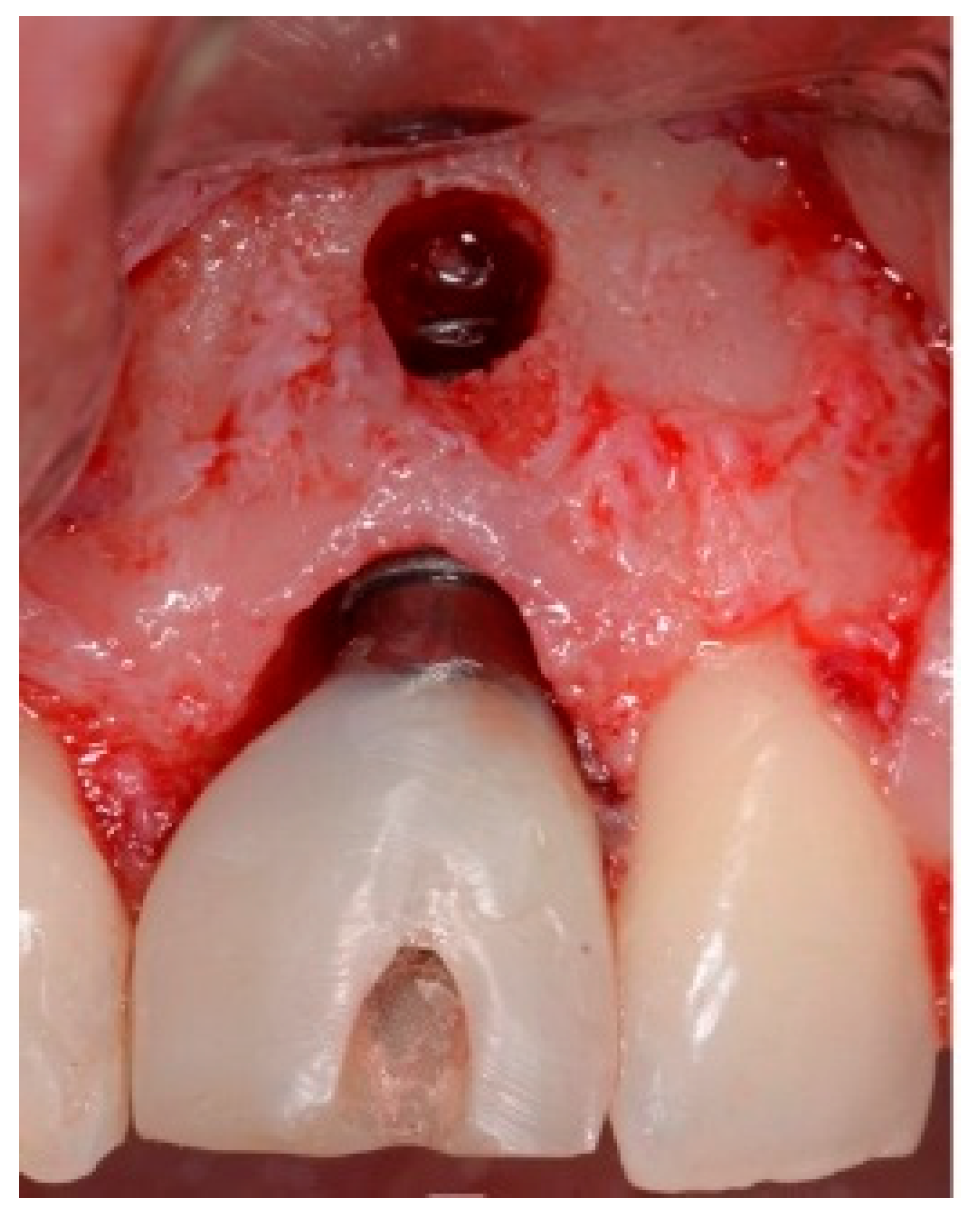 Dentistry 13 00185 g015