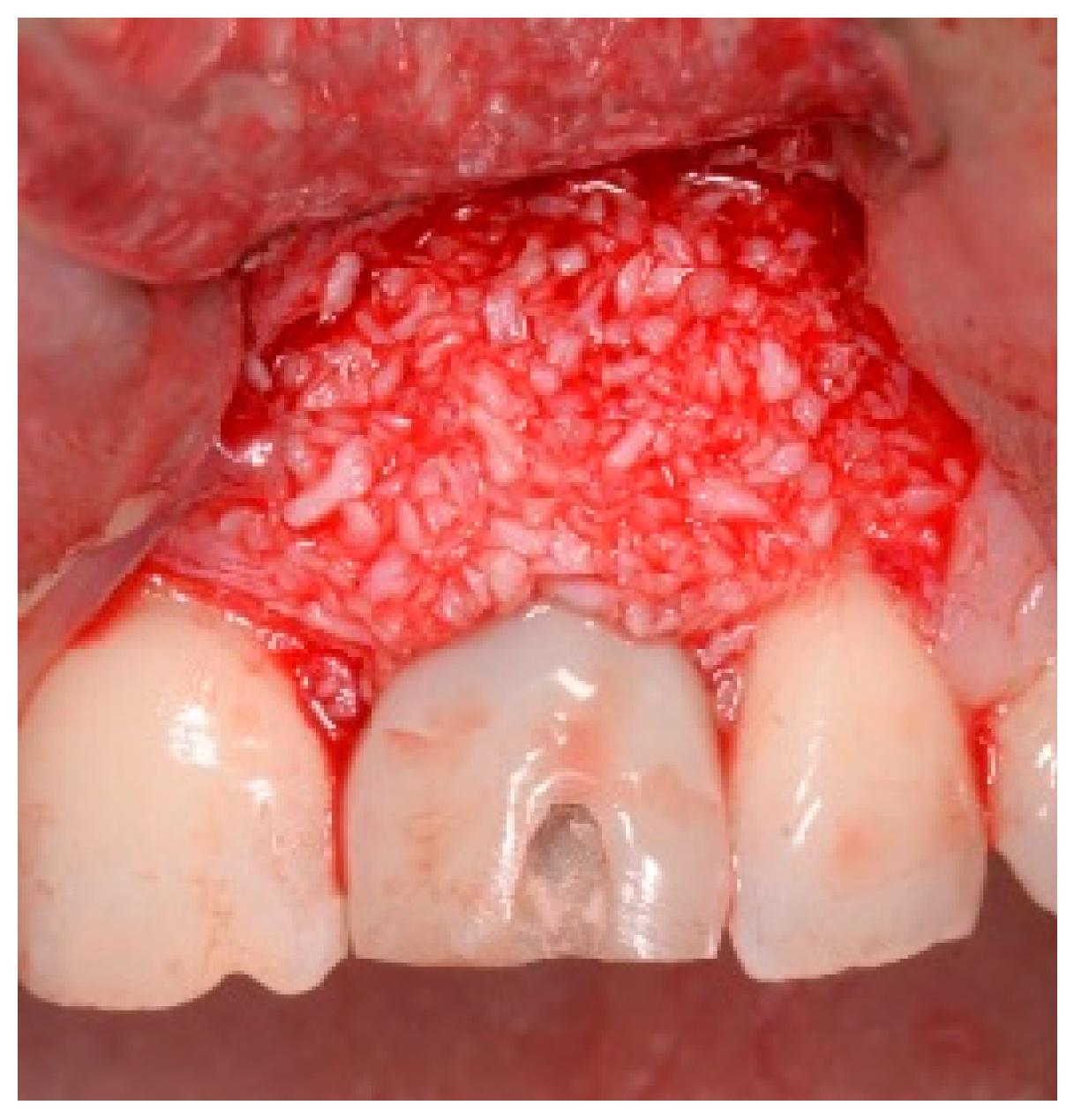 Dentistry 13 00185 g016