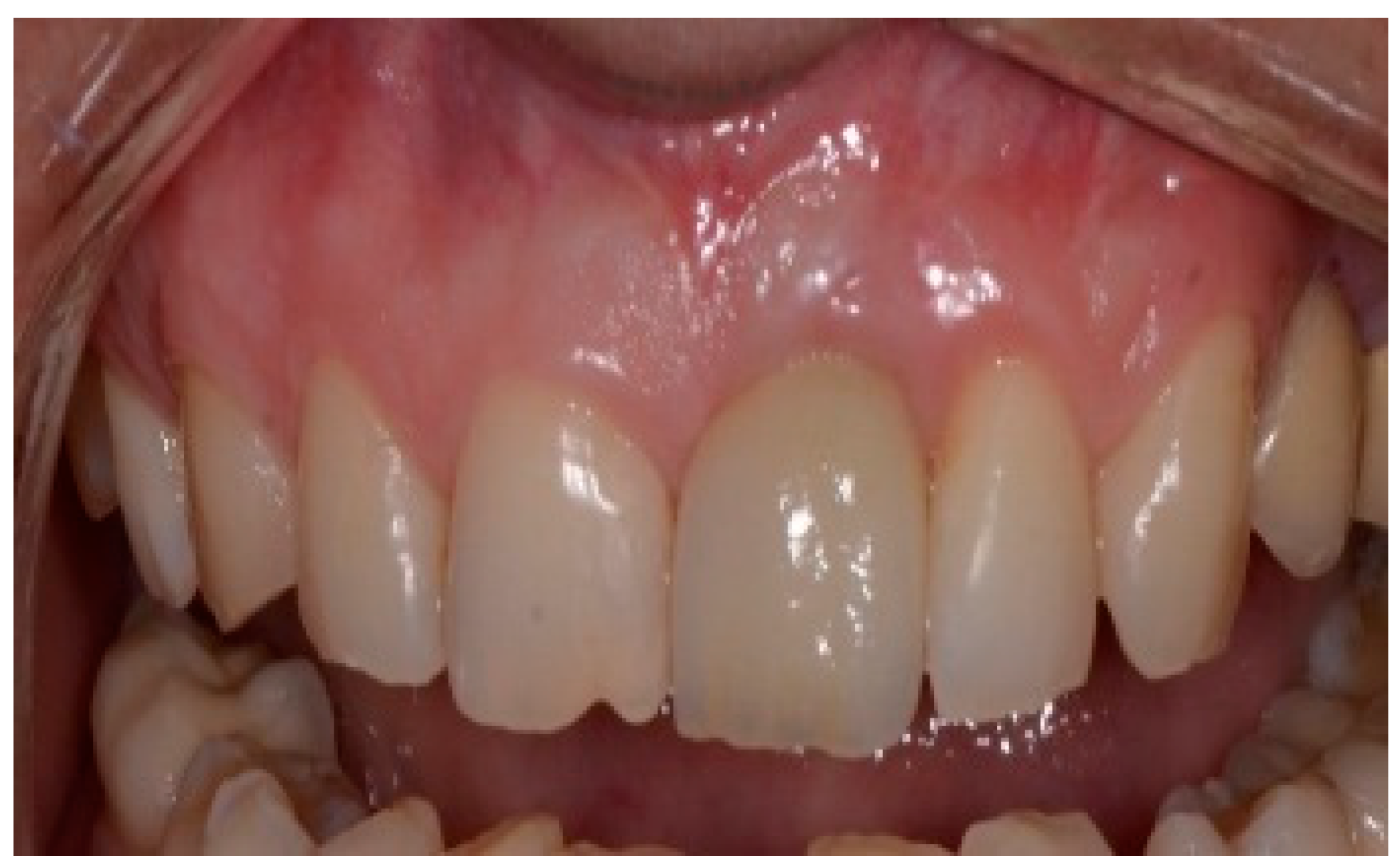 Dentistry 13 00185 g017