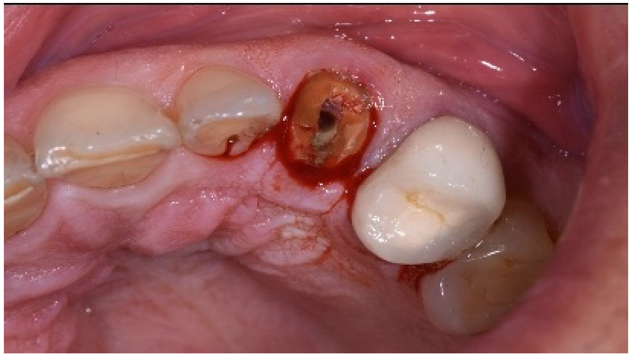 Dentistry 13 00185 g018