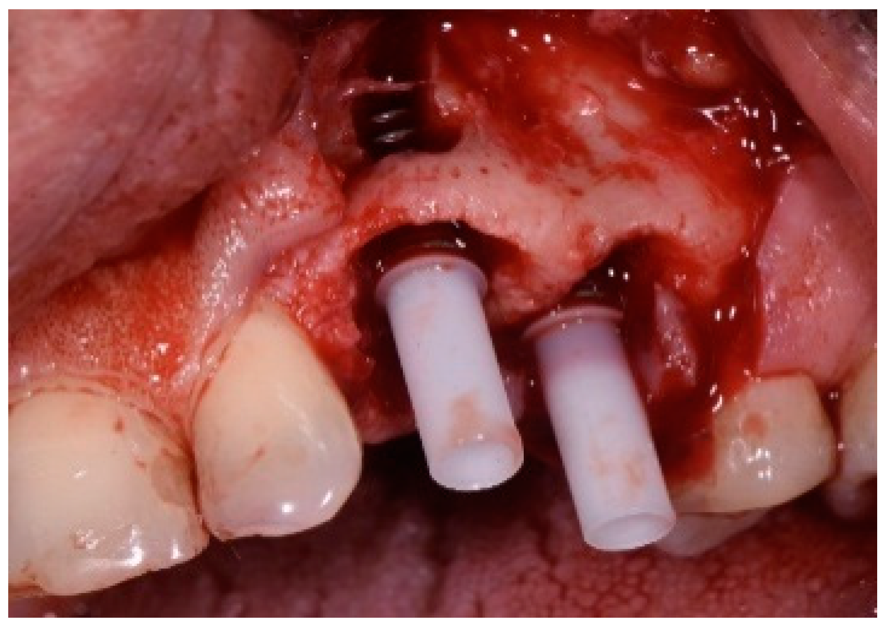 Dentistry 13 00185 g019