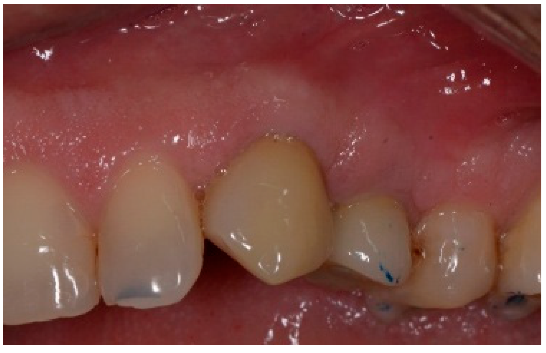 Dentistry 13 00185 g020