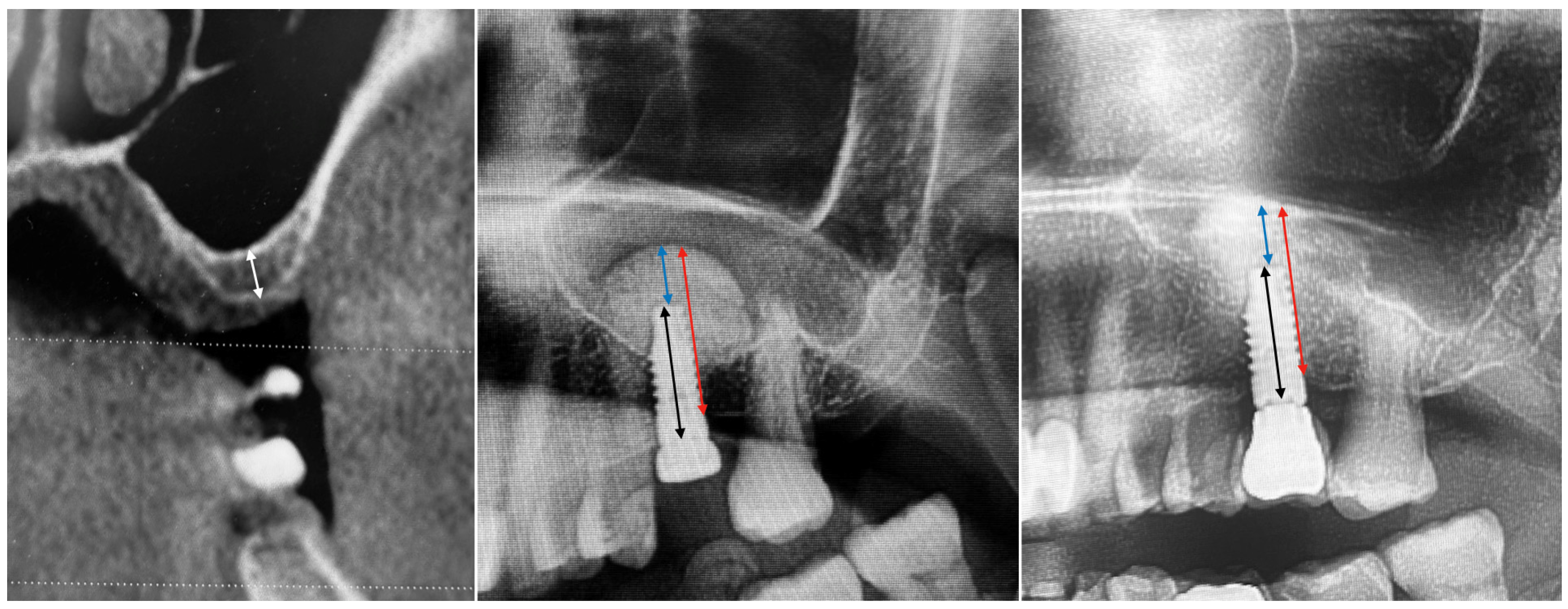 Dentistry 13 00193 g001