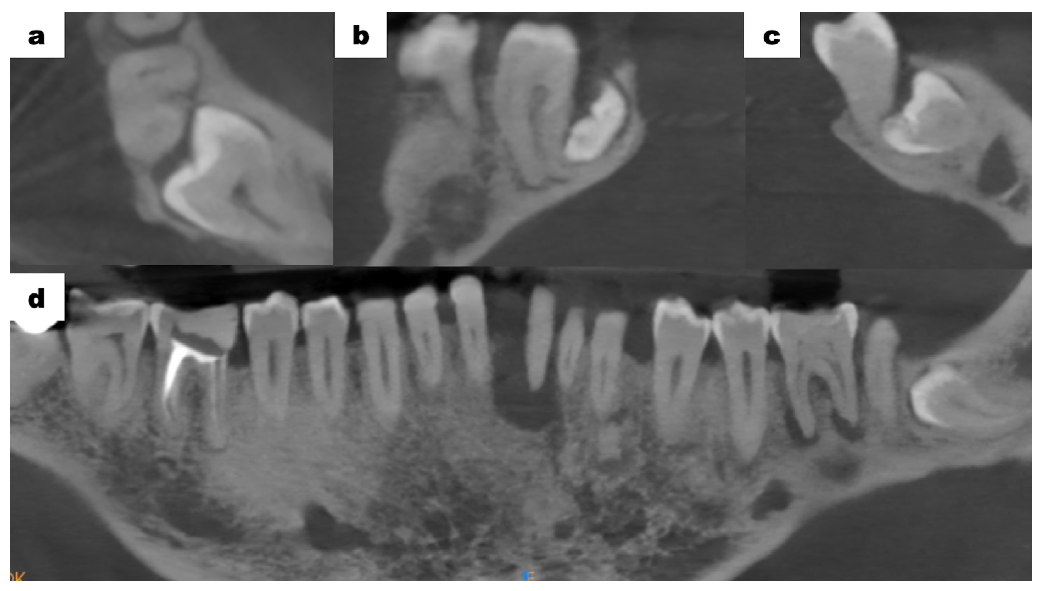 Dentistry 13 00217 g004