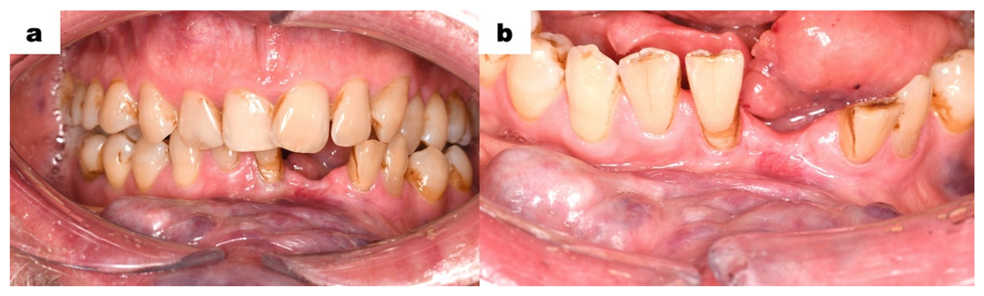 Dentistry 13 00217 g006