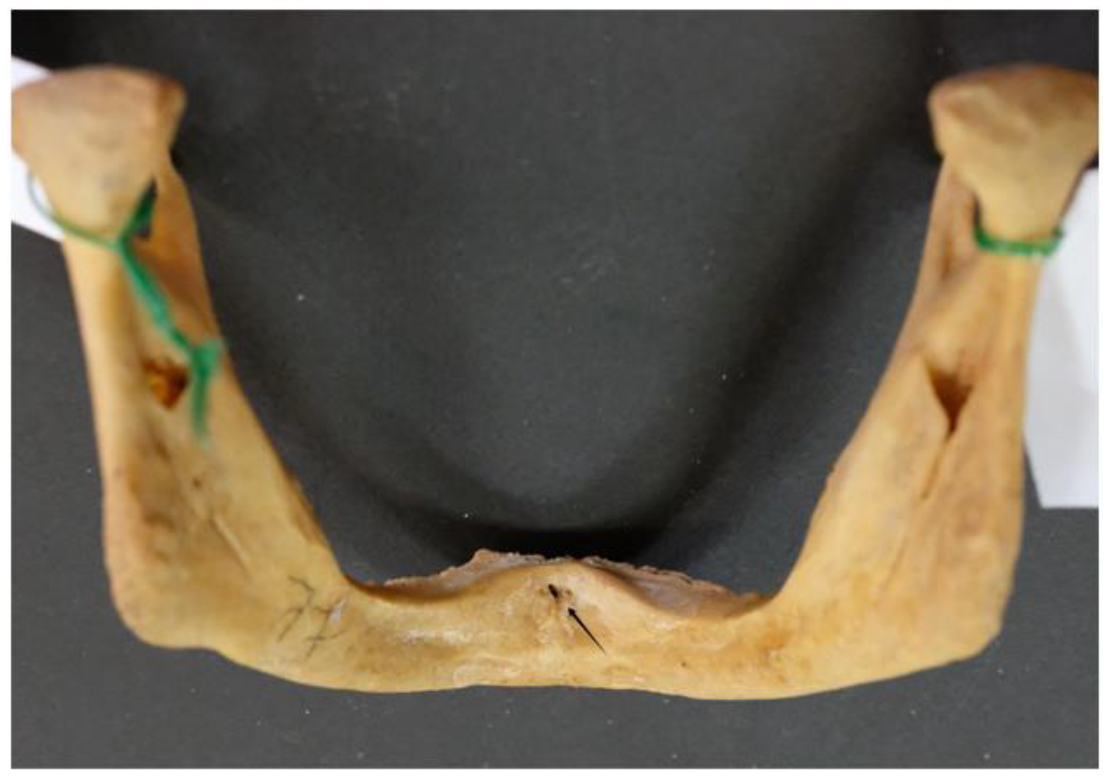 Dentistry 13 00218 g003