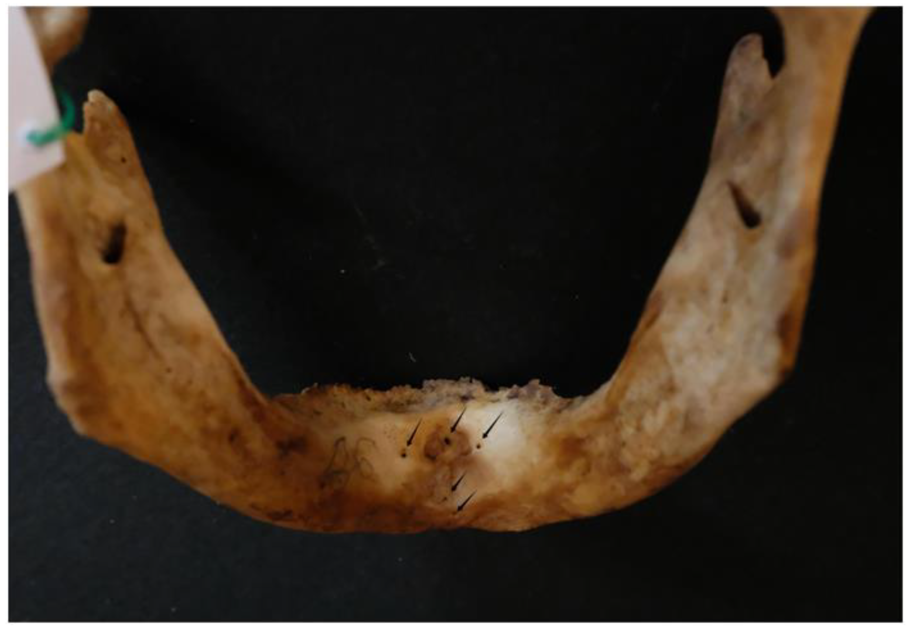 Dentistry 13 00218 g005