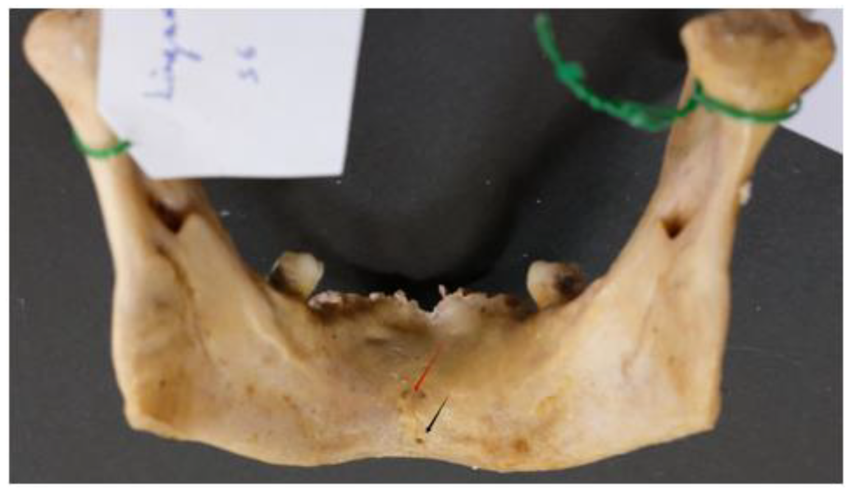 Dentistry 13 00218 g011