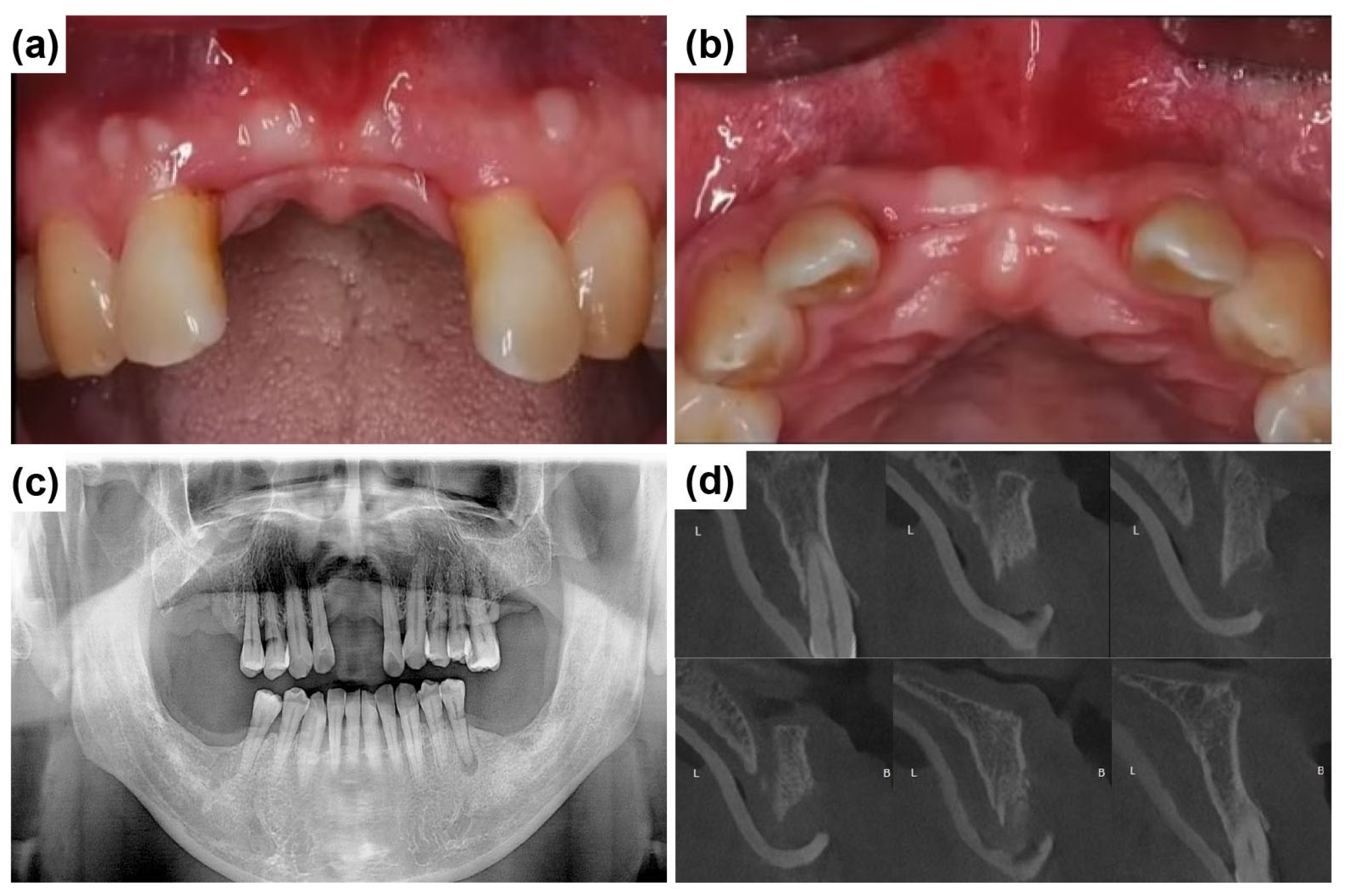 Dentistry 13 00241 g003