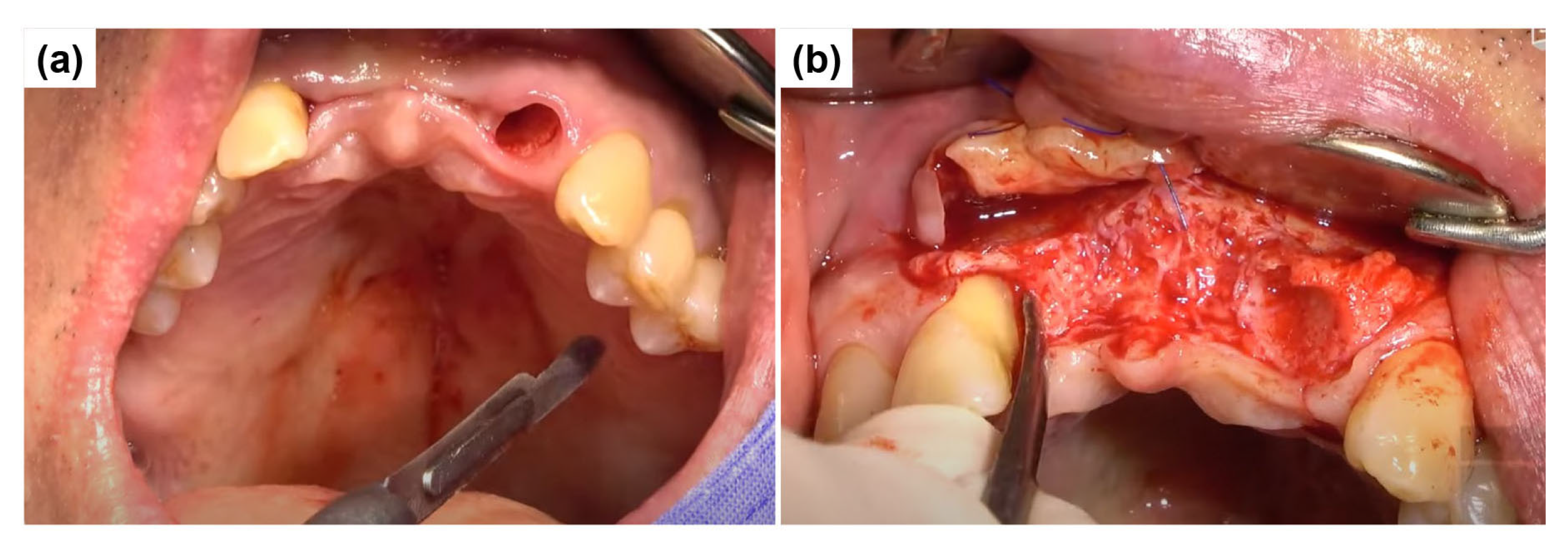 Dentistry 13 00241 g004