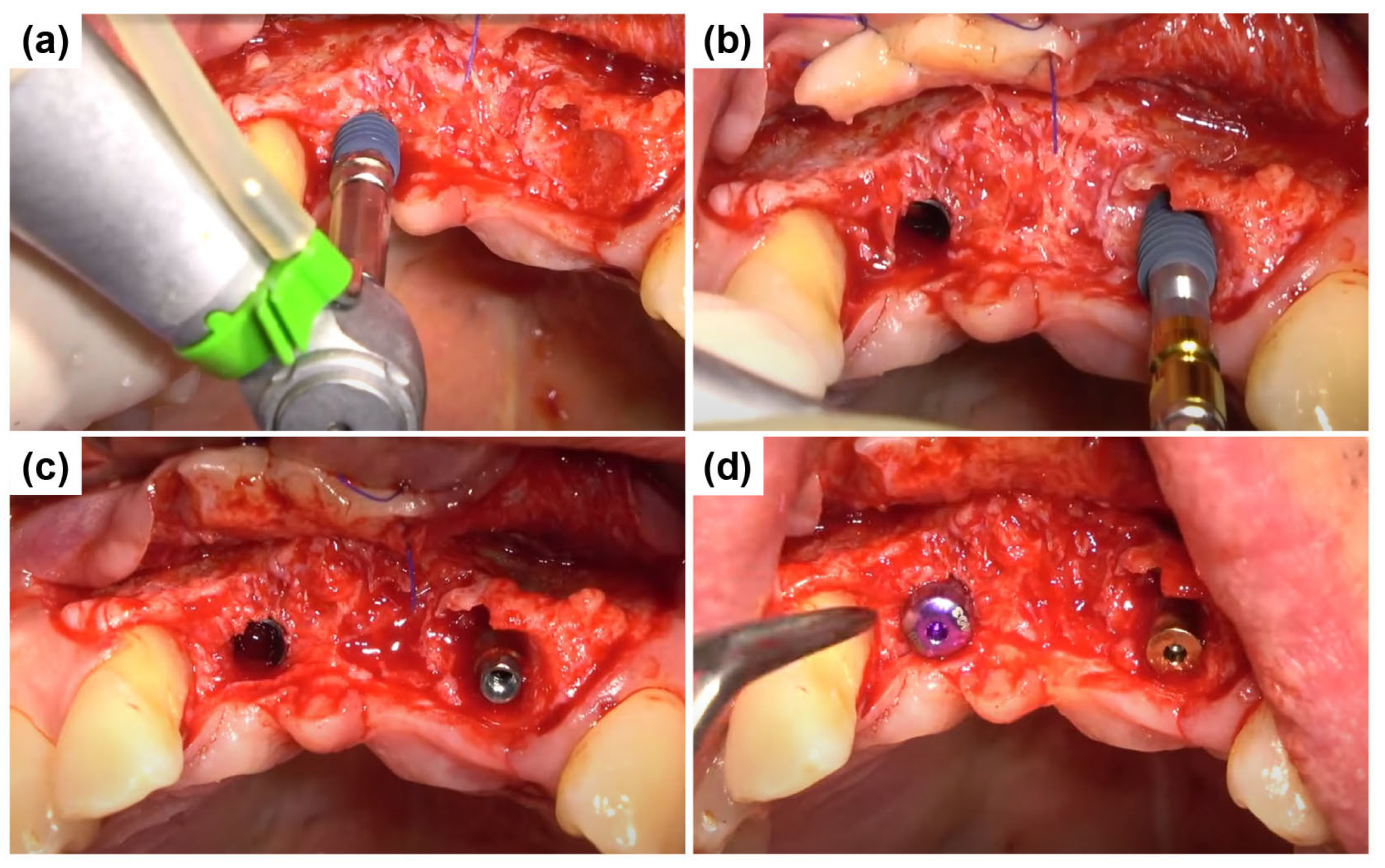 Dentistry 13 00241 g005