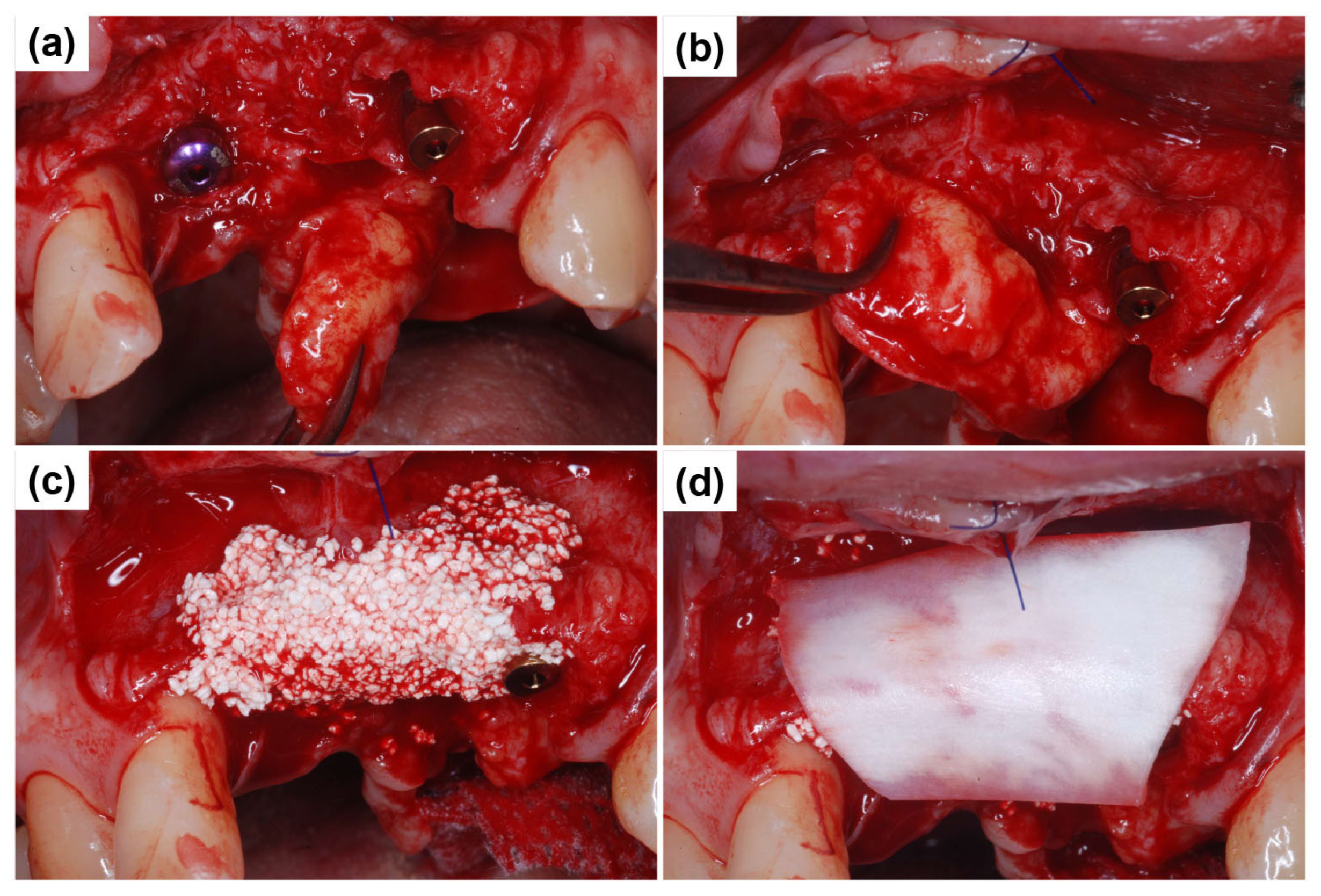 Dentistry 13 00241 g006