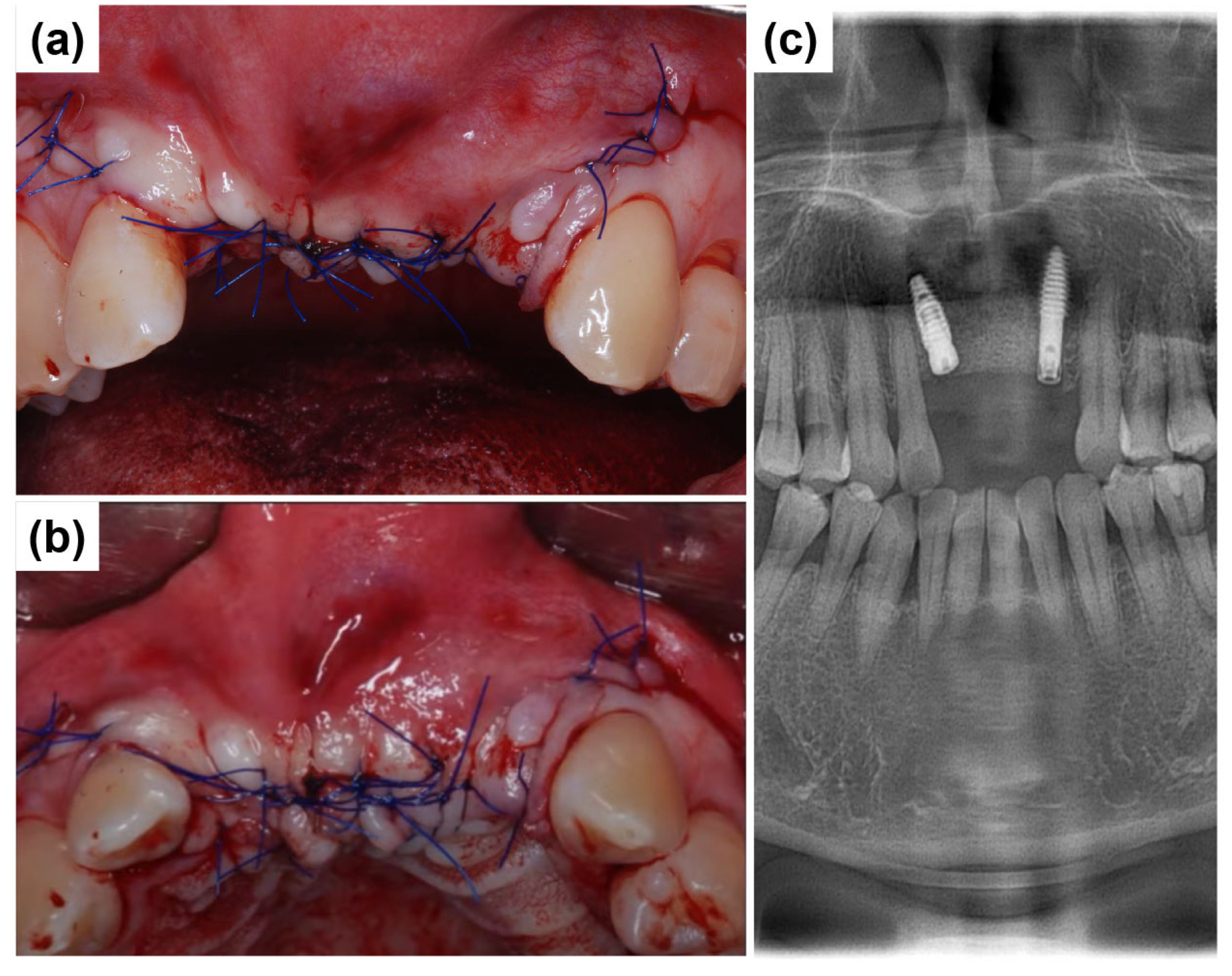 Dentistry 13 00241 g007