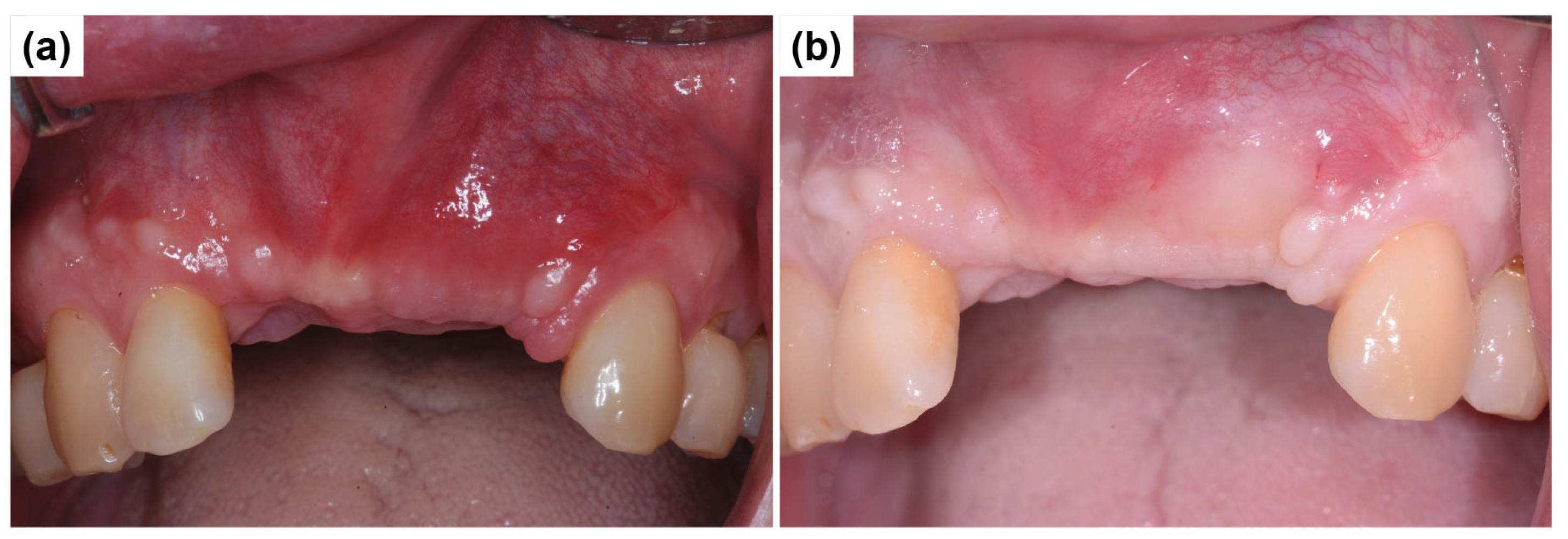 Dentistry 13 00241 g008