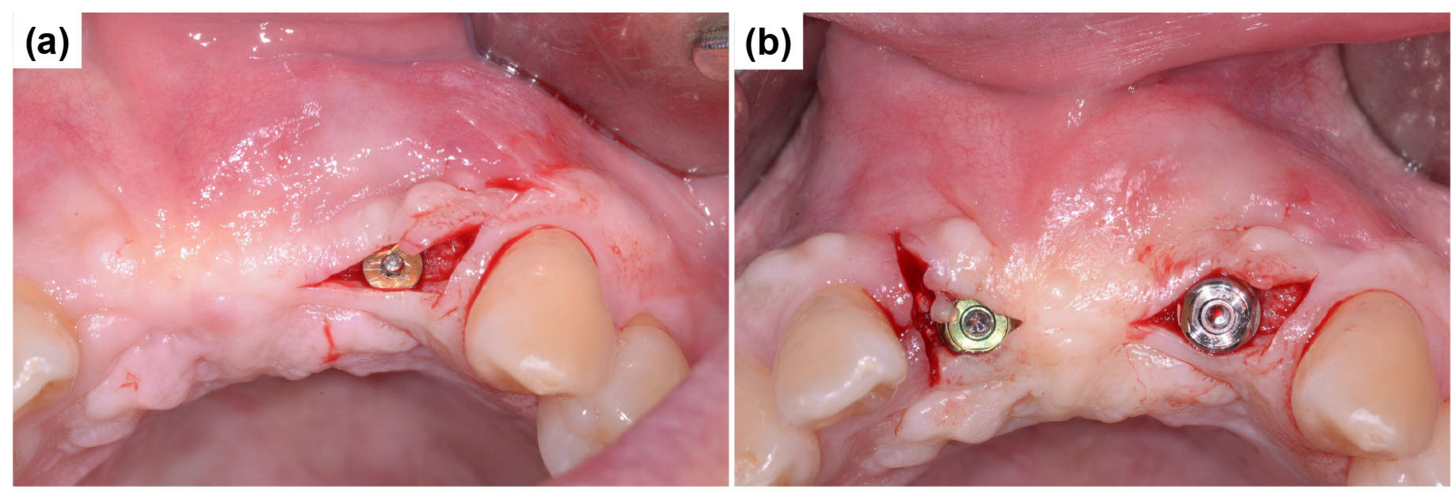 Dentistry 13 00241 g009