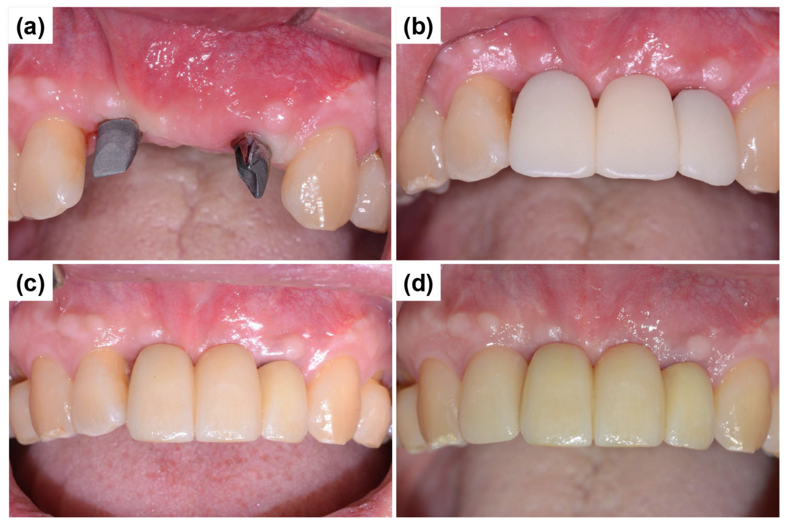 Dentistry 13 00241 g010