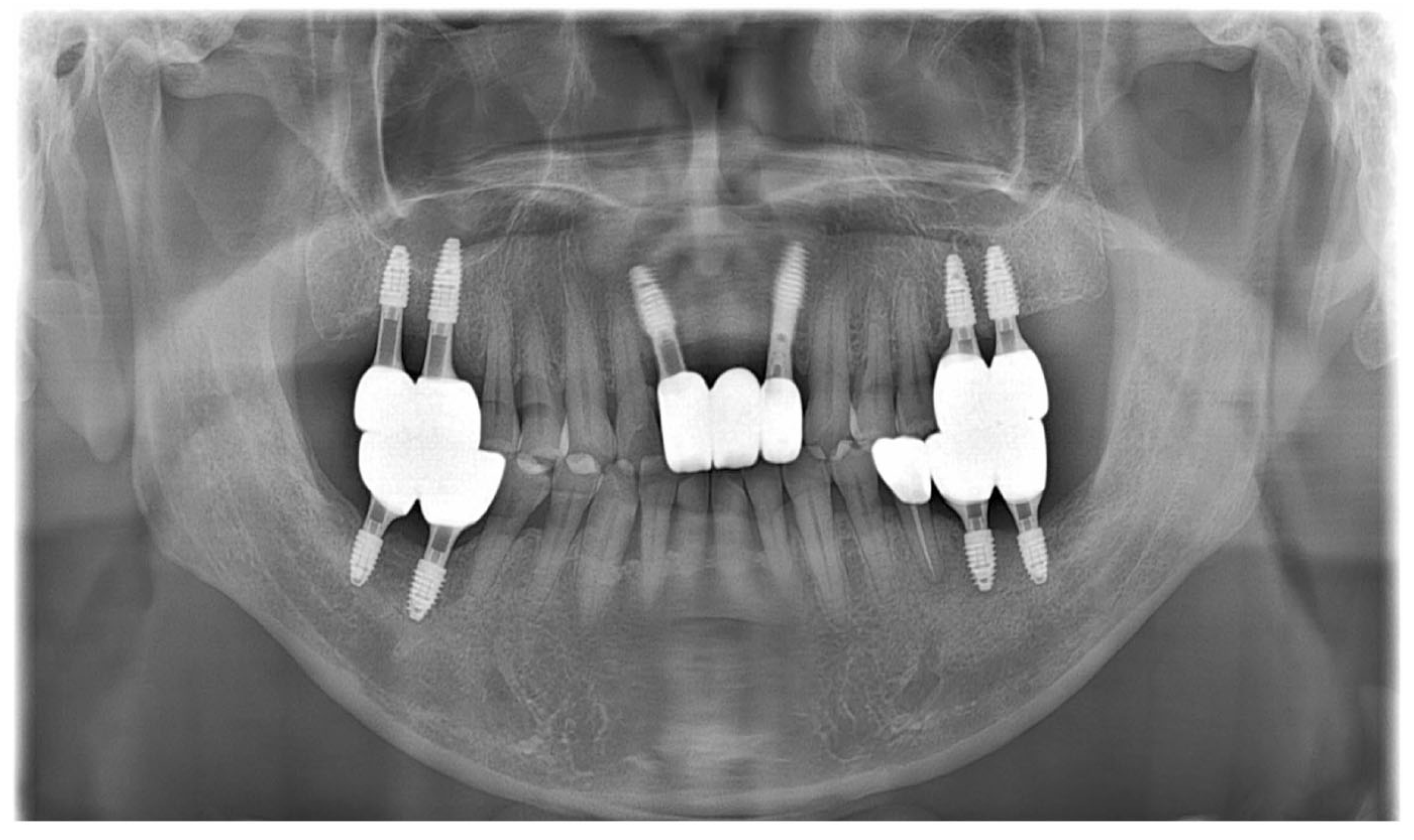 Dentistry 13 00241 g011