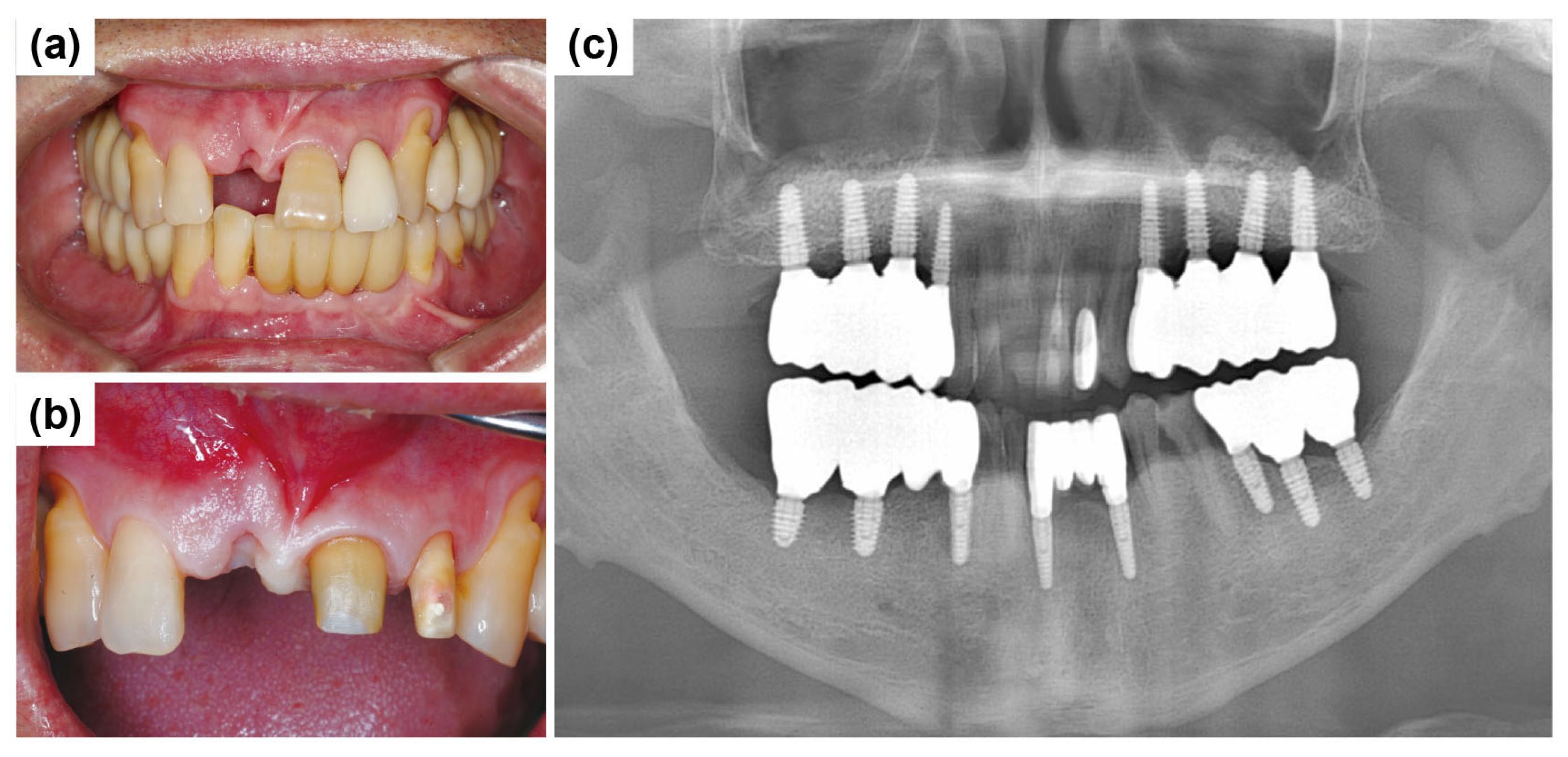 Dentistry 13 00241 g012