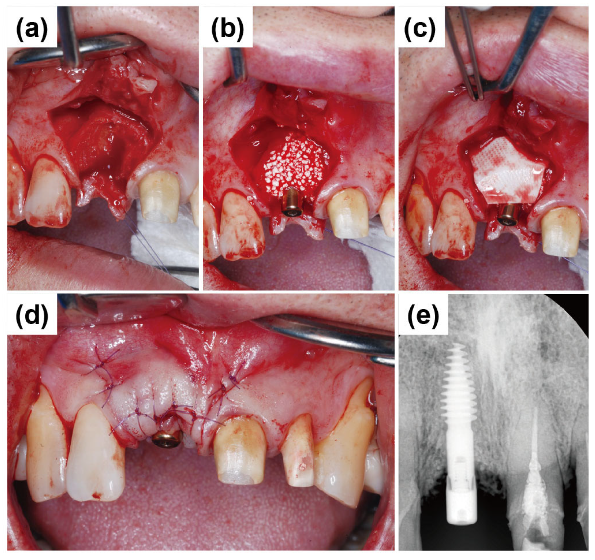 Dentistry 13 00241 g013