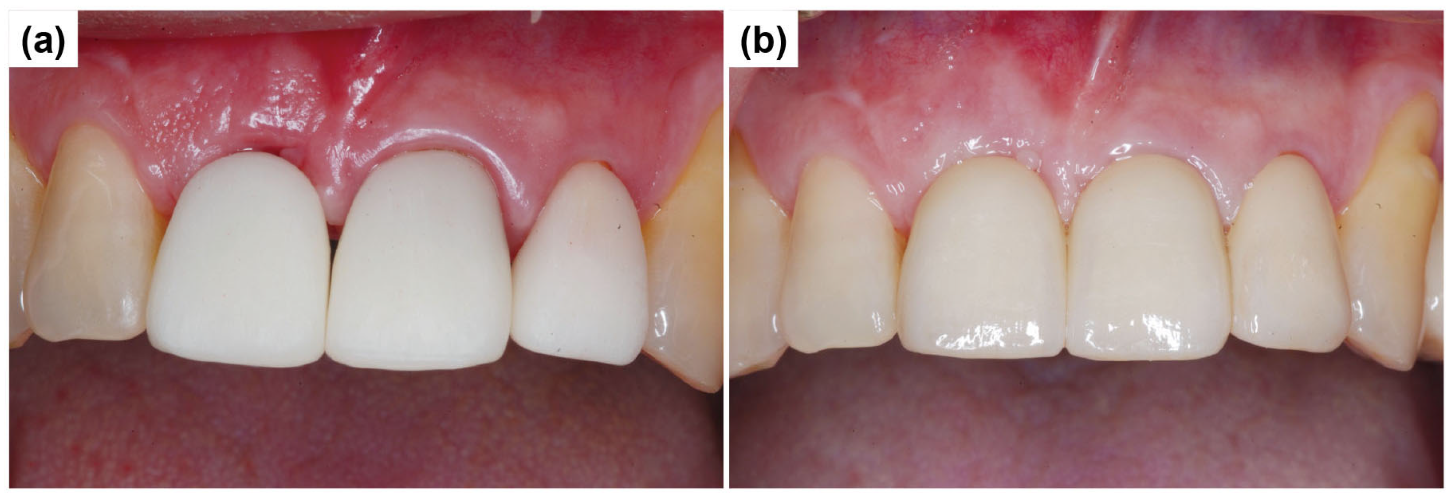 Dentistry 13 00241 g014
