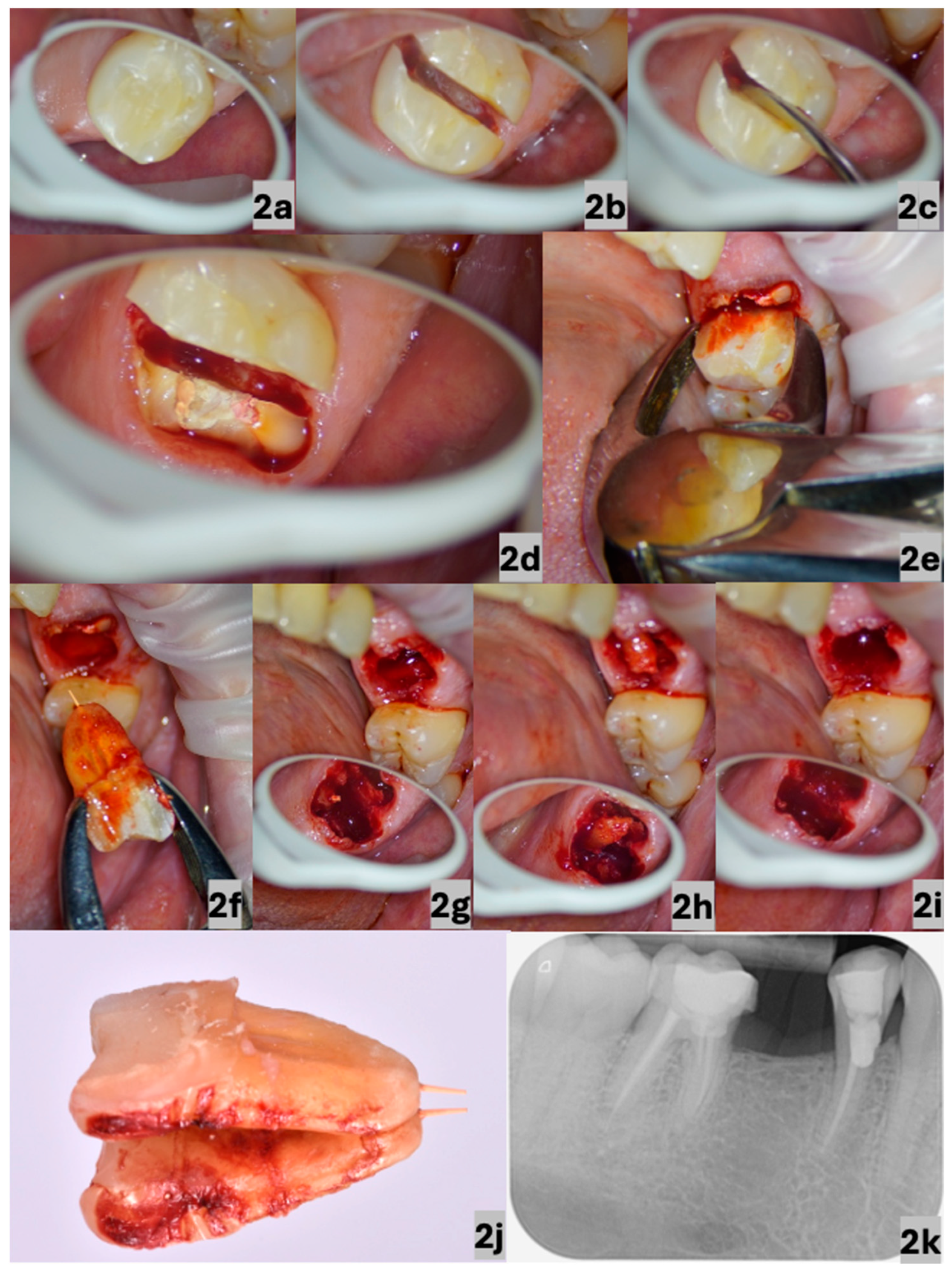 Dentistry 13 00243 g002